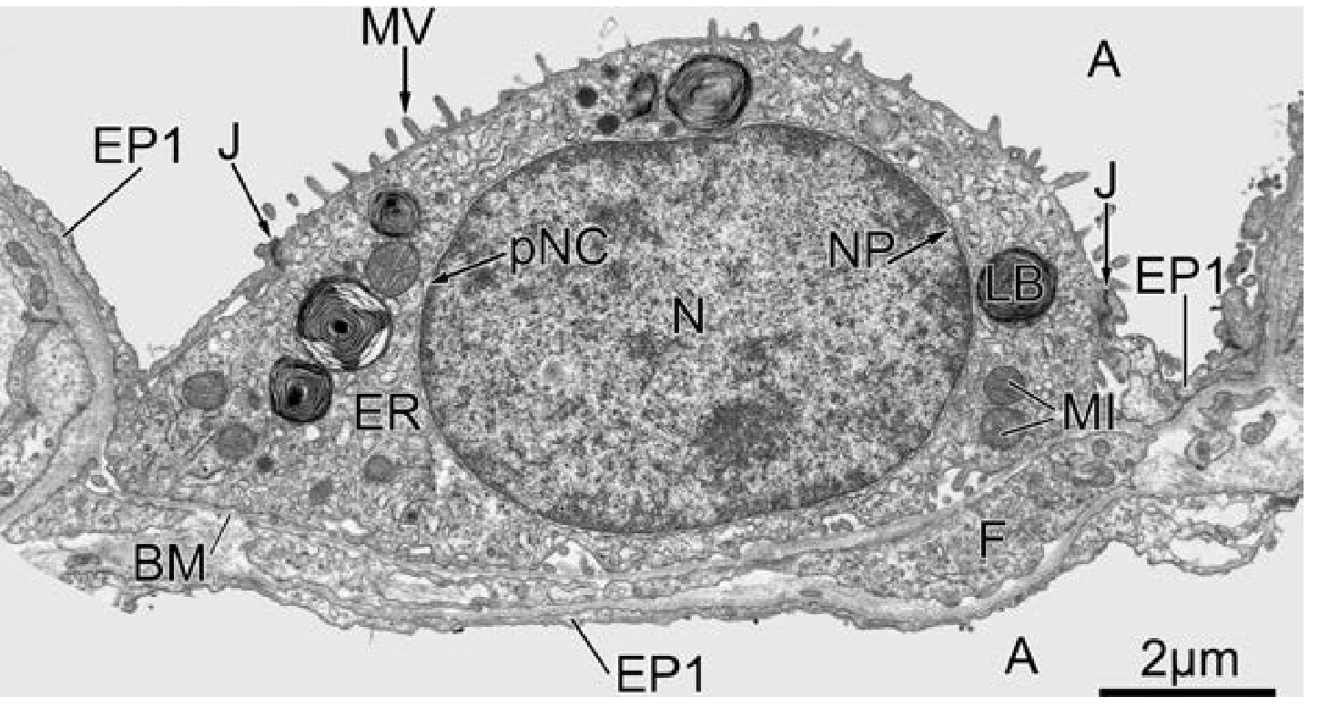 Type II alveolar epithelial cell - transmission electron micrograph from Fishman's showing LB (lamellar bodies), ER (endoplasmic reticulum), MI (mitochondria), MV (microvilli), N (nucleus), pNC (perinuclear cisterna), BM (basement membrane), J (junction with type I cells)