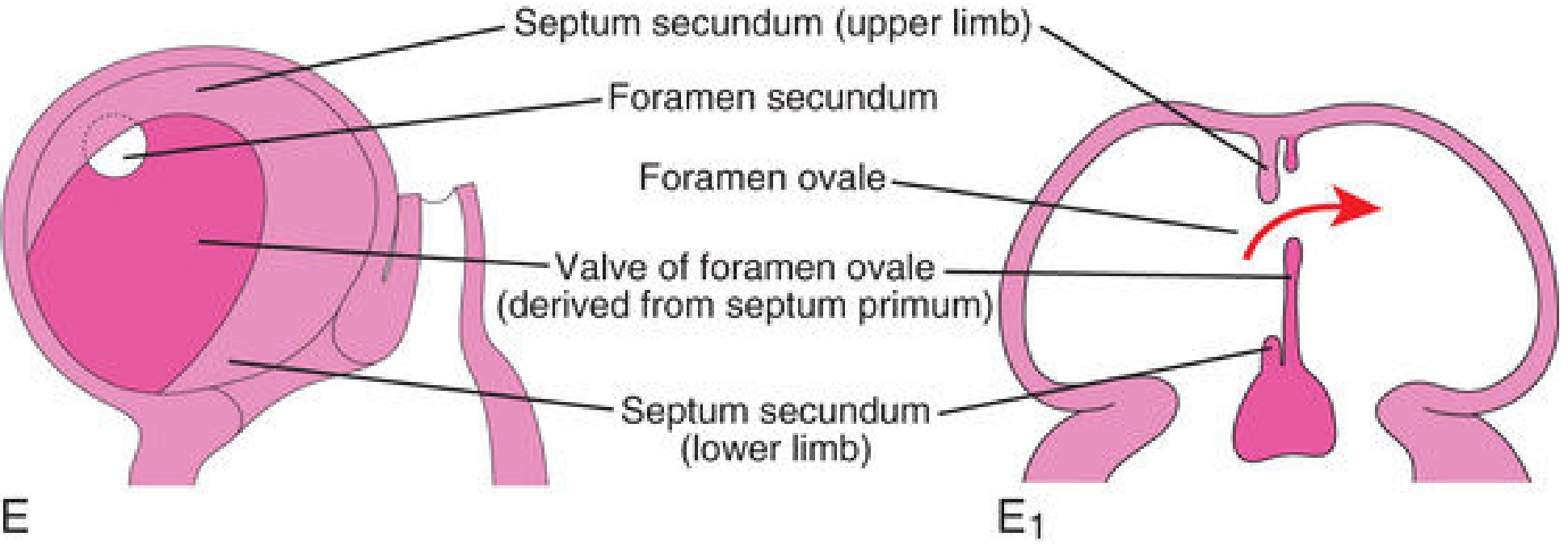 Atrial septation showing septum secundum, foramen secundum, foramen ovale, and the valve of foramen ovale derived from septum primum