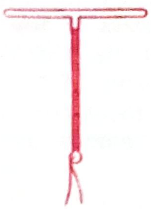 Cu-T-200B - T-shaped copper IUD