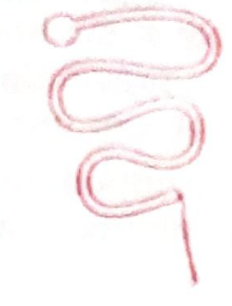 Lippes Loop - double-S shaped inert IUD