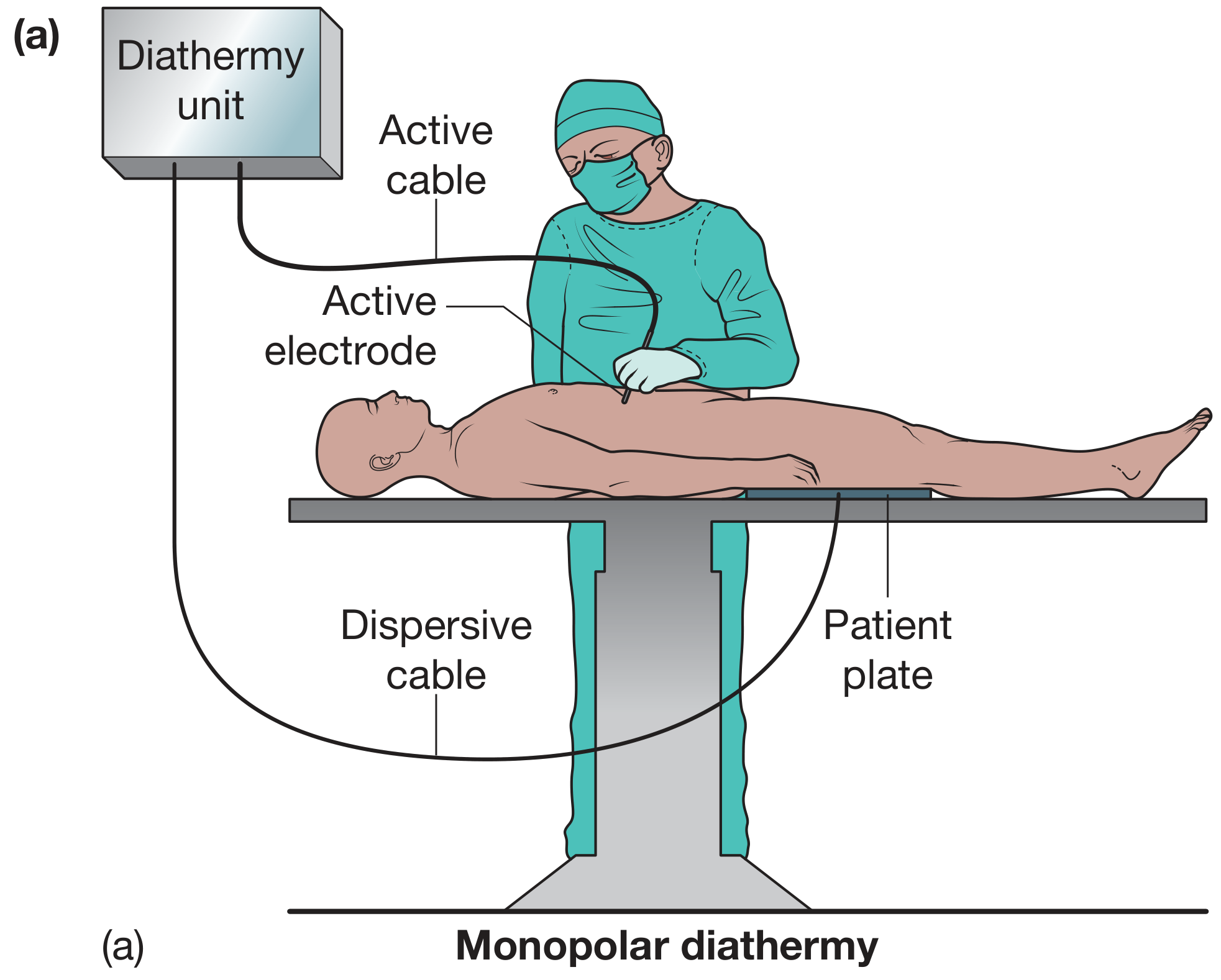 Monopolar diathermy setup showing diathermy unit, active cable, active electrode on patient, dispersive cable, and patient plate