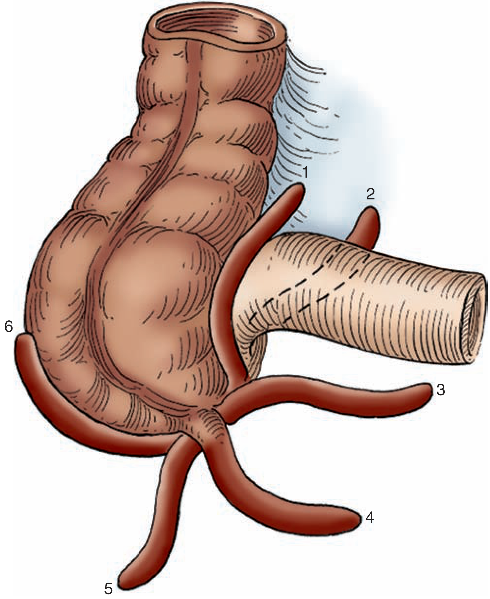 Anatomic variation in position of the appendix - Maingot's Fig 31-1