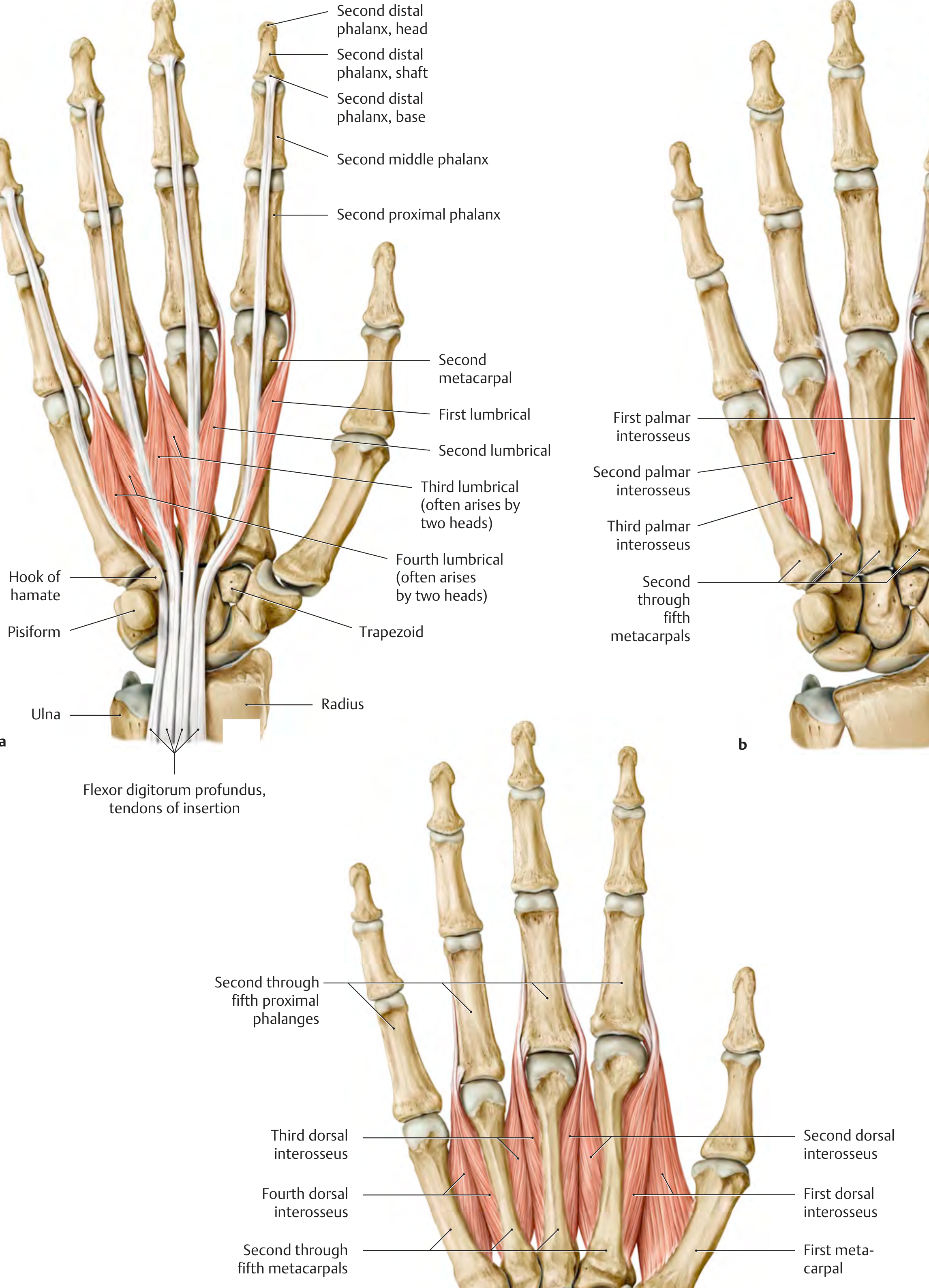 Lumbricals (a), Palmar interossei (b), and Dorsal interossei (c) - right hand, palmar view