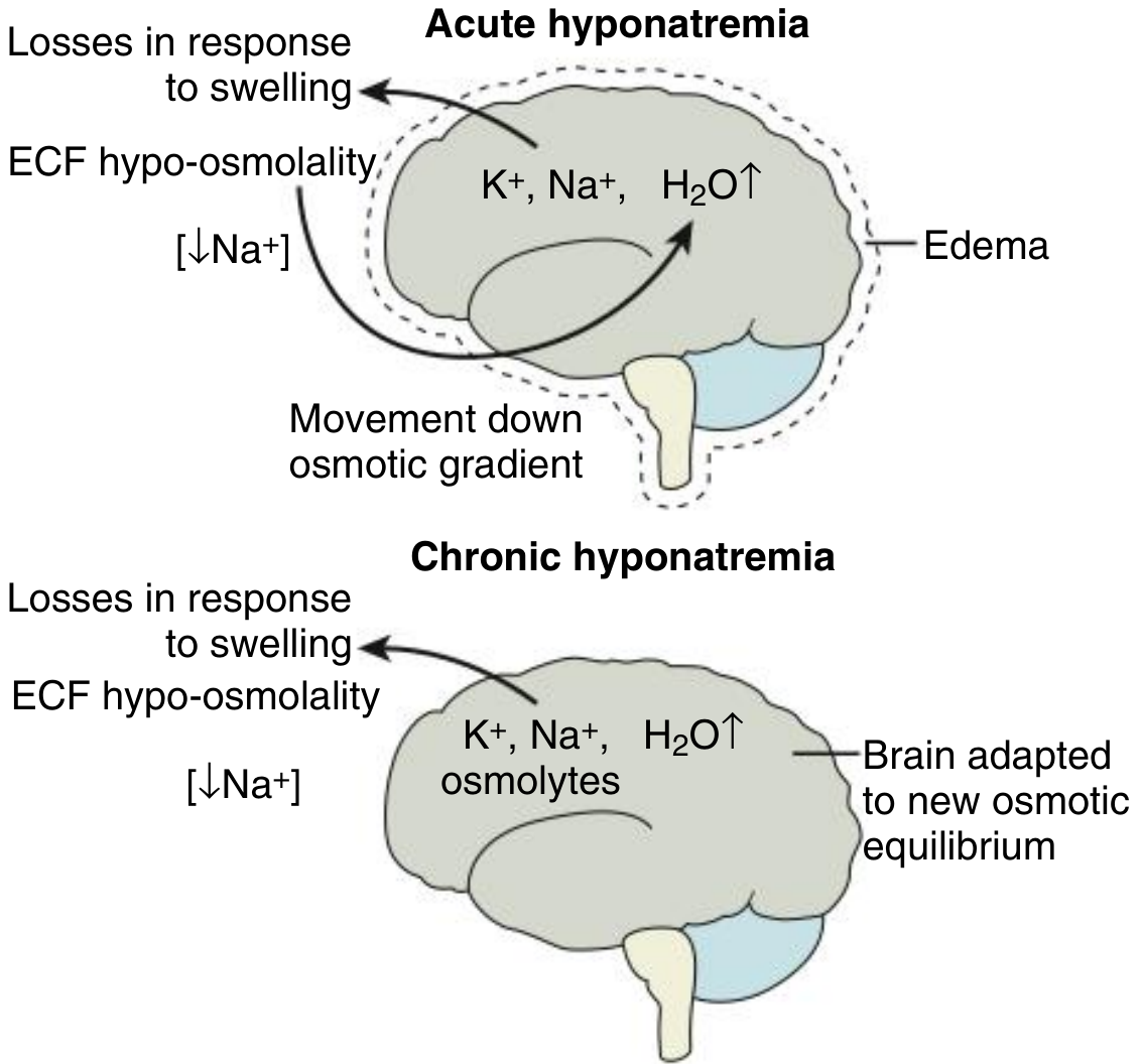 Brain Volume Adaptation to Hyponatremia - acute water influx with NaCl exit, followed by organic osmolyte loss in chronic phase