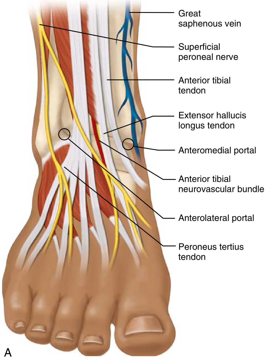 Anterior ankle arthroscopy portals showing anteromedial and anterolateral portal positions with surrounding neurovascular anatomy