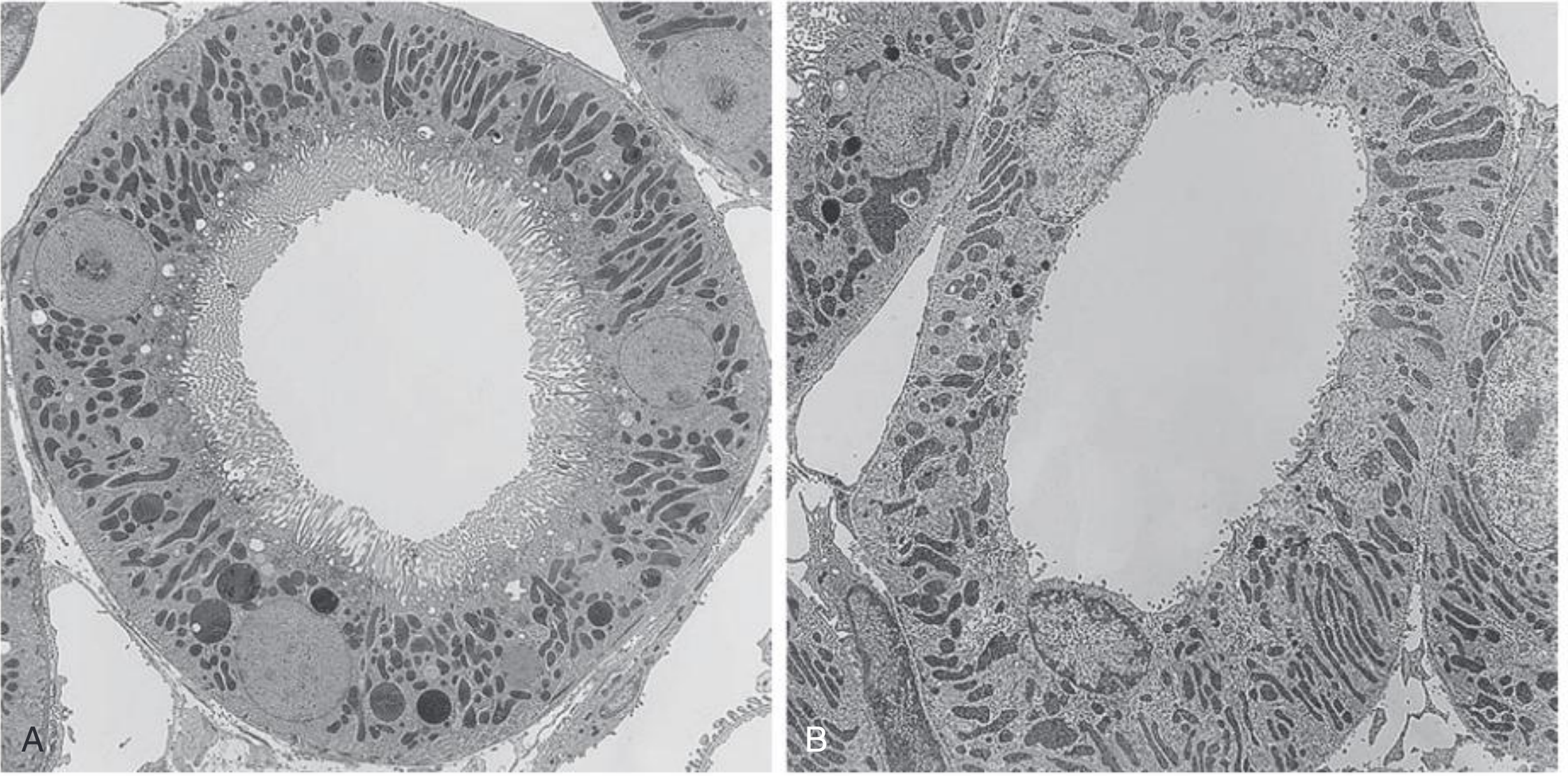 TEM of Proximal Convoluted Tubule (A) and Distal Convoluted Tubule (B) - showing brush border/microvilli in PCT vs. stubby microvilli in DCT, with basal labyrinth of mitochondria in both