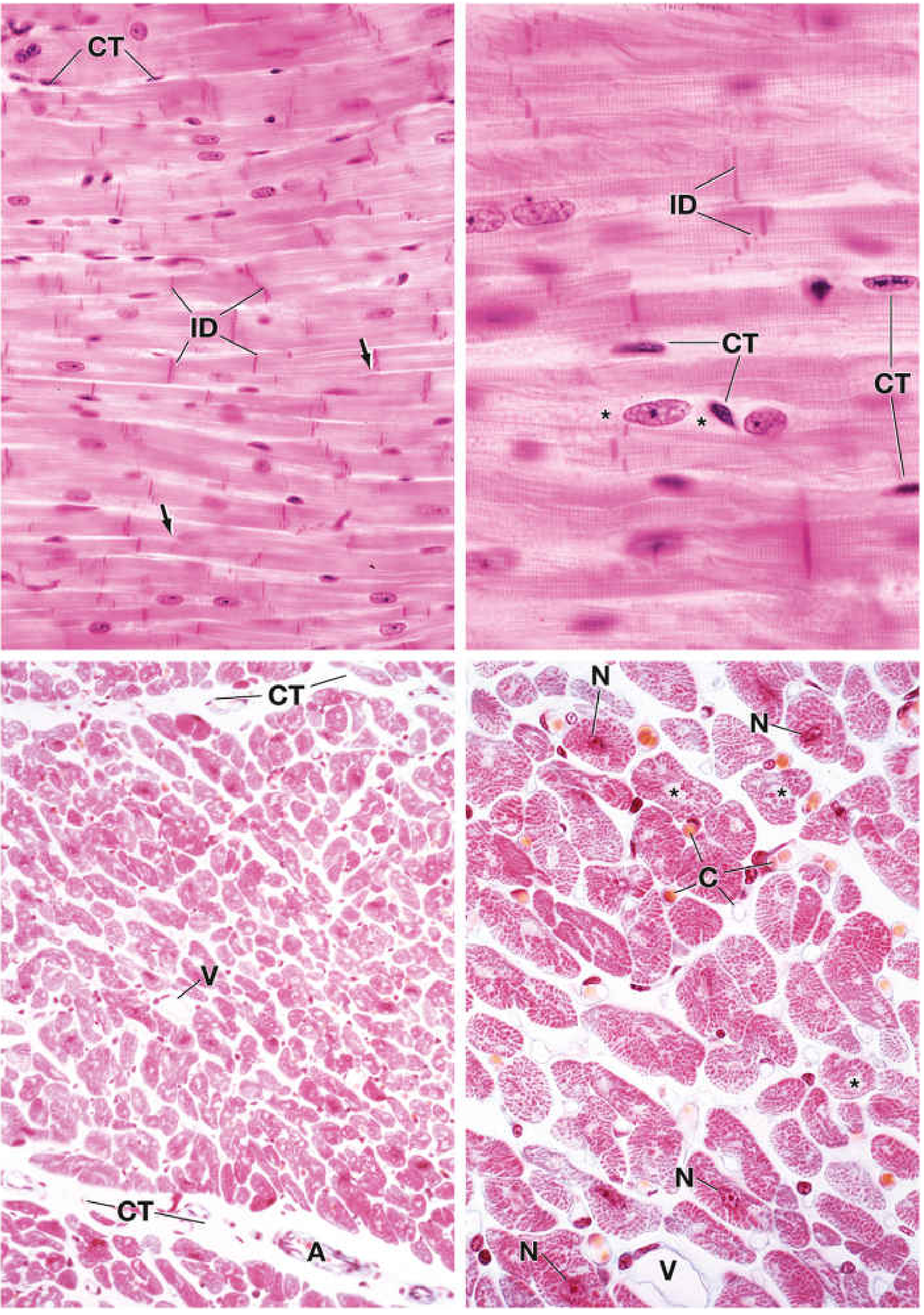 Cardiac muscle H&E photomicrograph showing branching fibers (top panels: longitudinal sections with intercalated discs ID; bottom panels: cross sections with central nuclei N, capillaries C, and connective tissue CT)