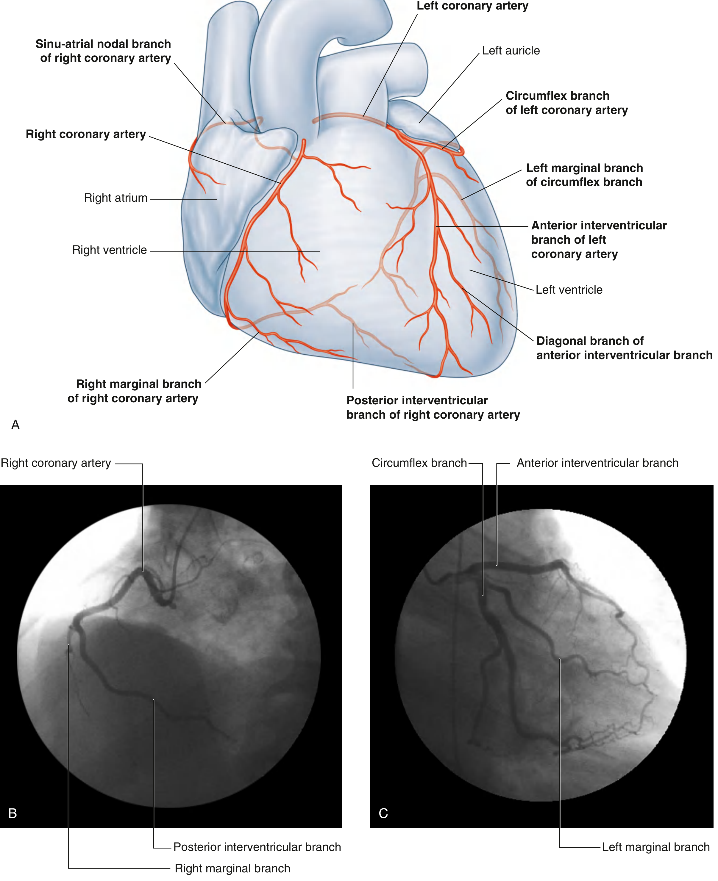 Coronary artery anatomy - anterior view with angiography