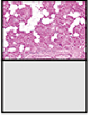 Parotid gland H&E x160 - purely serous acini with adipose cells