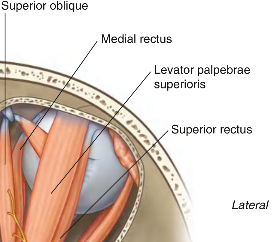CN III orbital muscles - Superior oblique, Medial rectus, Superior rectus, Levator palpebrae superioris as seen in the orbit