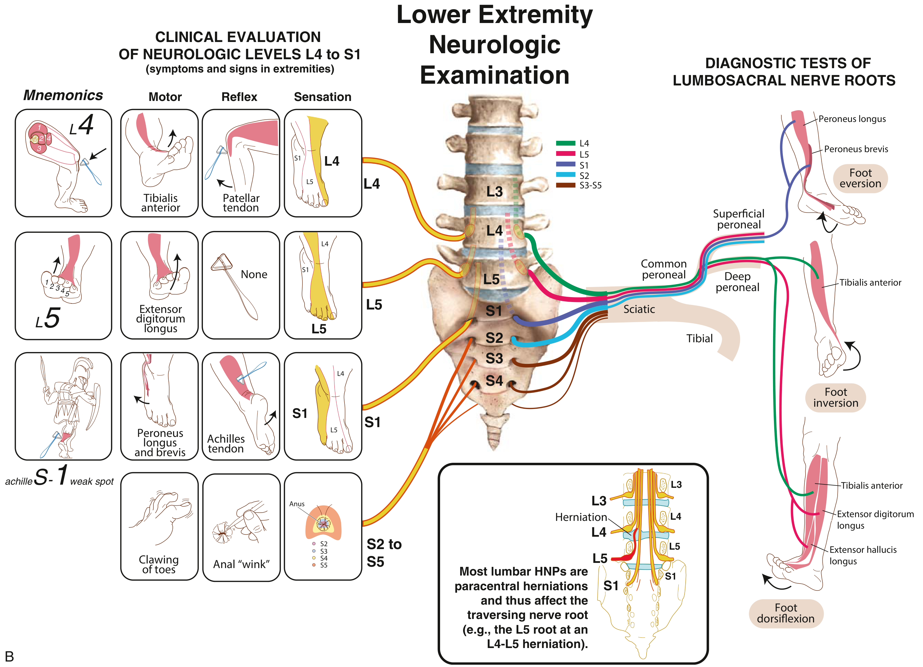 Lower Extremity Neurologic Examination - L4 to S1 with nerve root anatomy