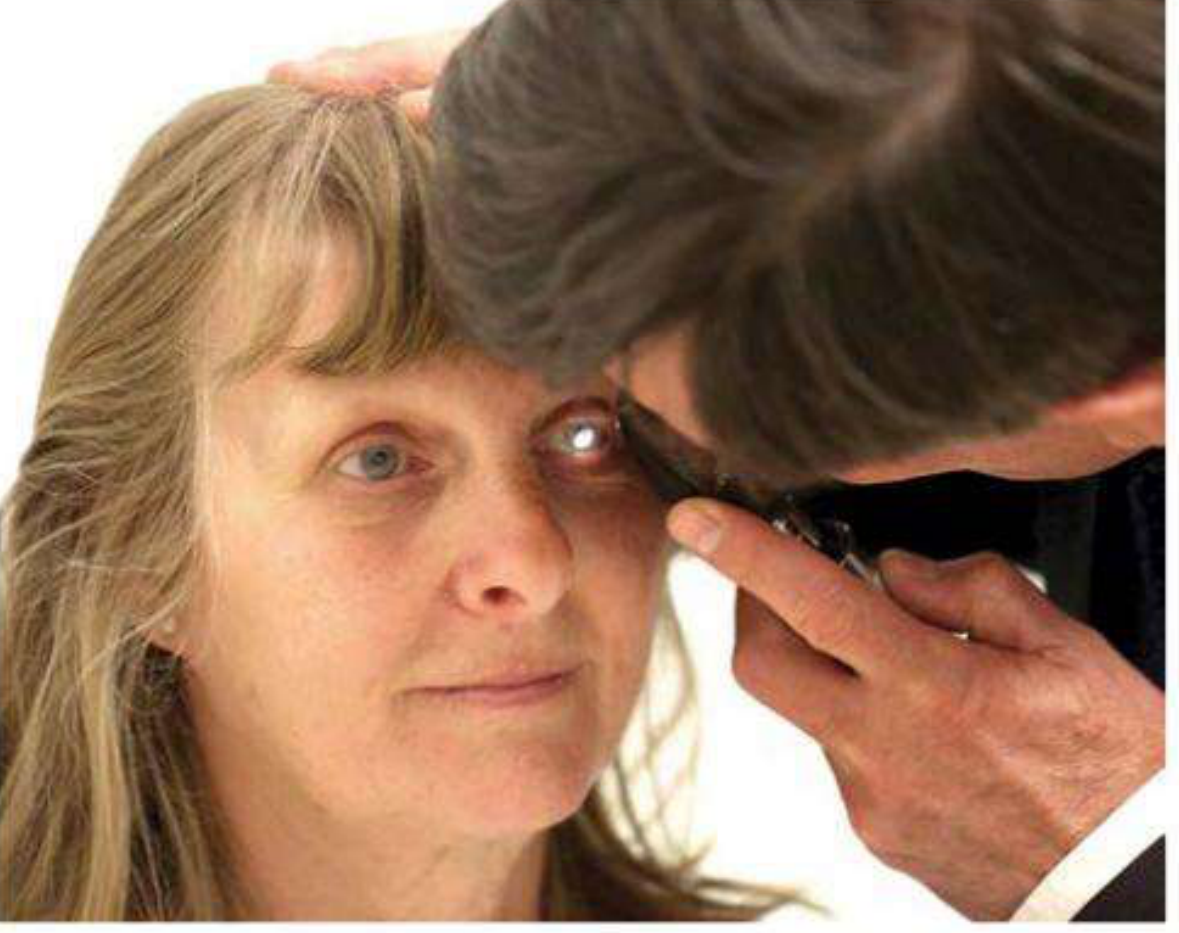 Technique of direct ophthalmoscopy