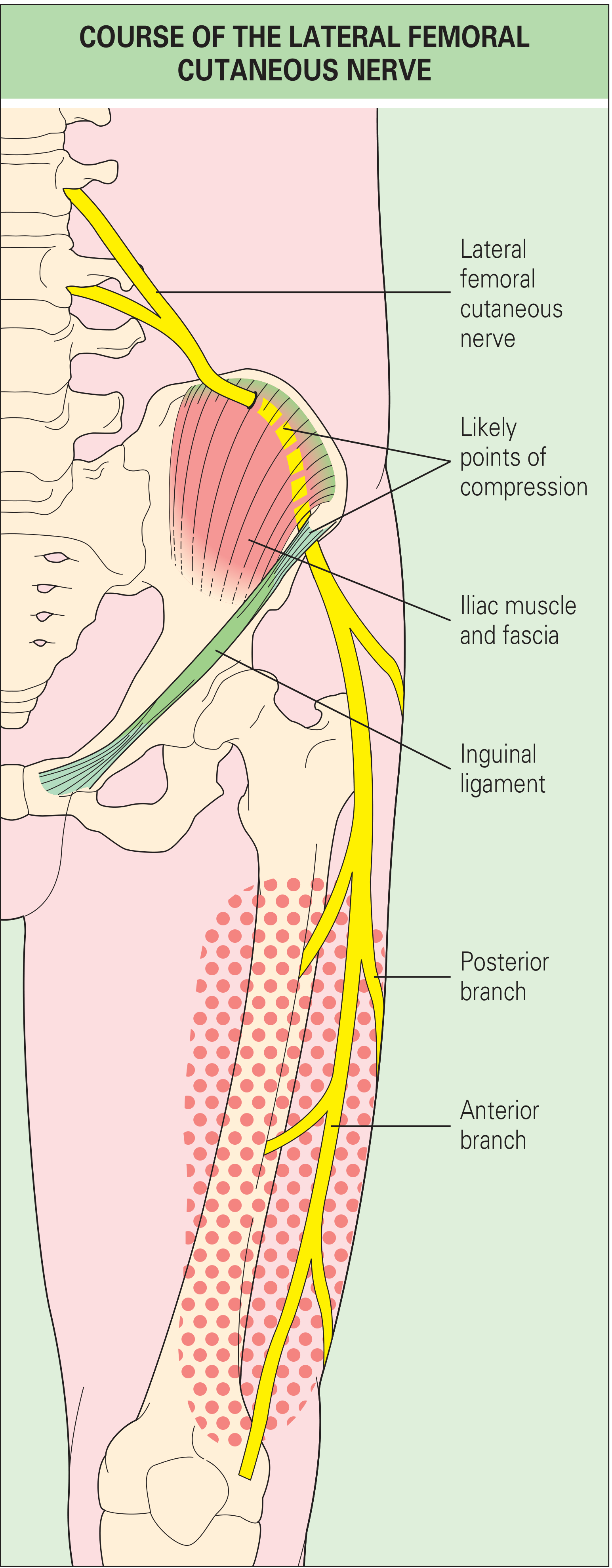 Course of the Lateral Femoral Cutaneous Nerve