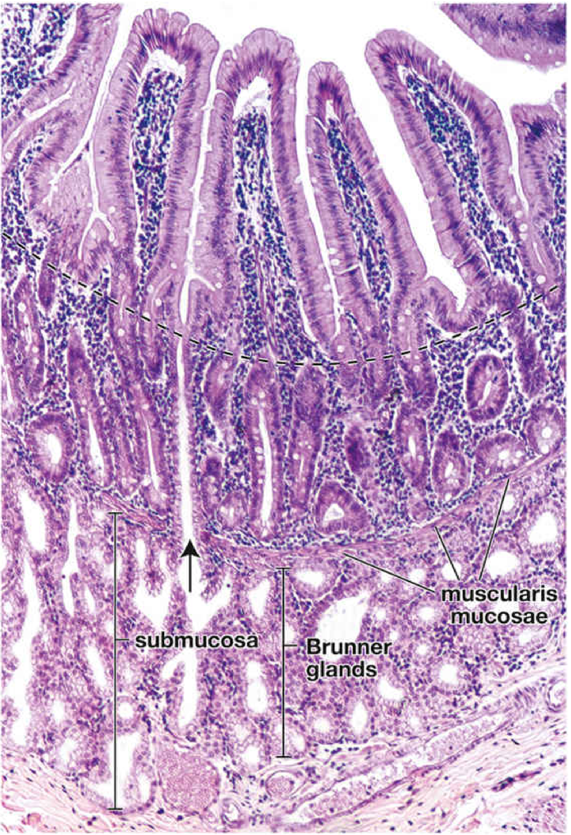 Duodenum H&E showing villi, crypts, and Brunner glands in submucosa