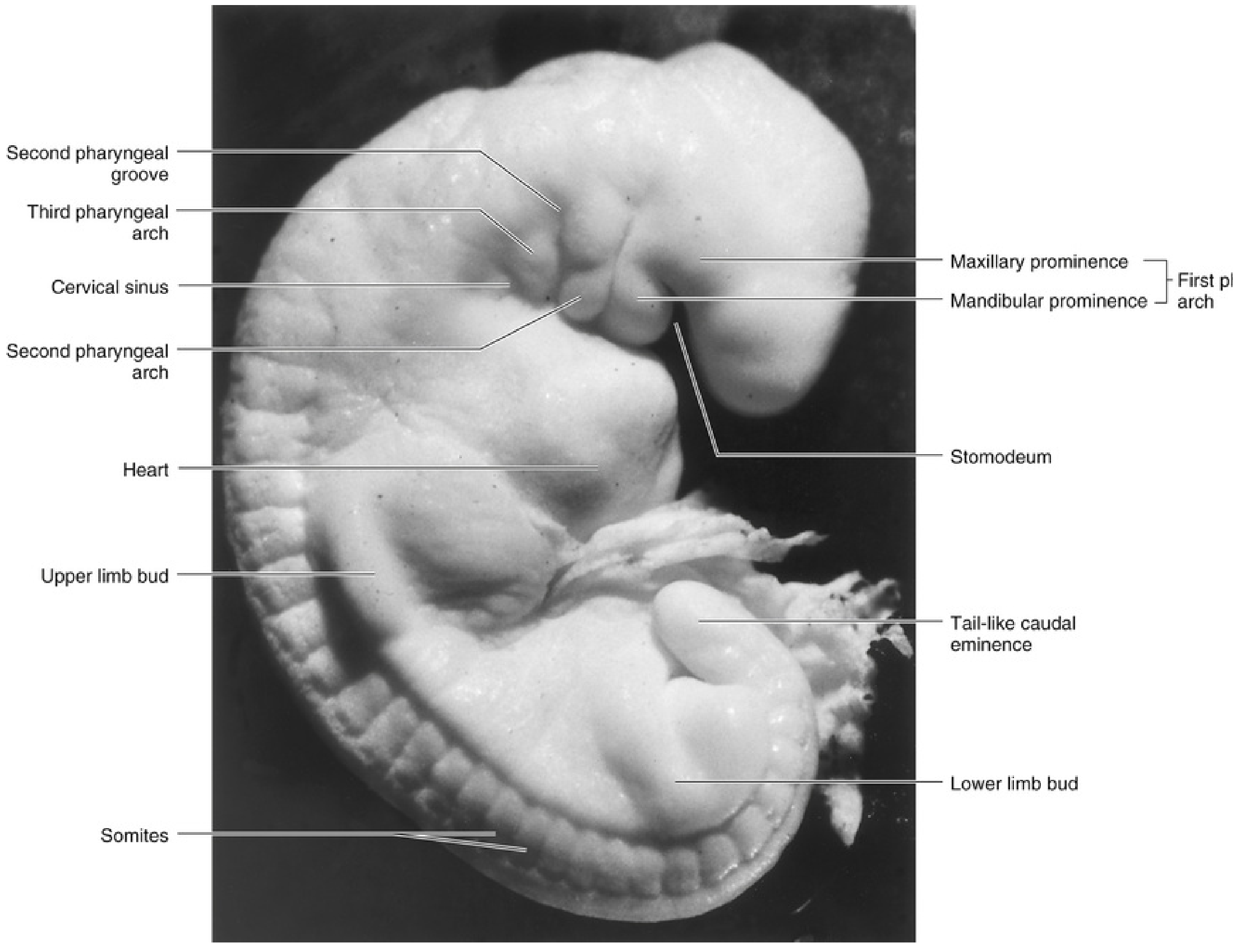 Human embryo showing pharyngeal arches