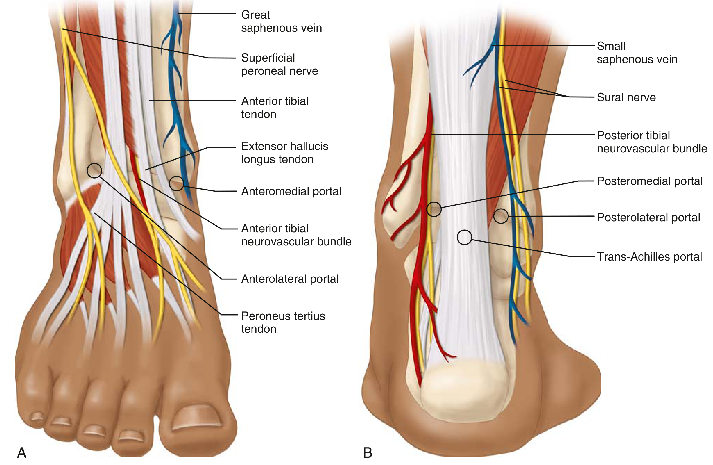 Anterior and posterior ankle arthroscopy portal anatomy showing anteromedial portal (risk: saphenous nerve), anterolateral portal (risk: superficial peroneal nerve), posteromedial portal (risk: posterior tibial neurovascular bundle), and posterolateral portal (risk: sural nerve)