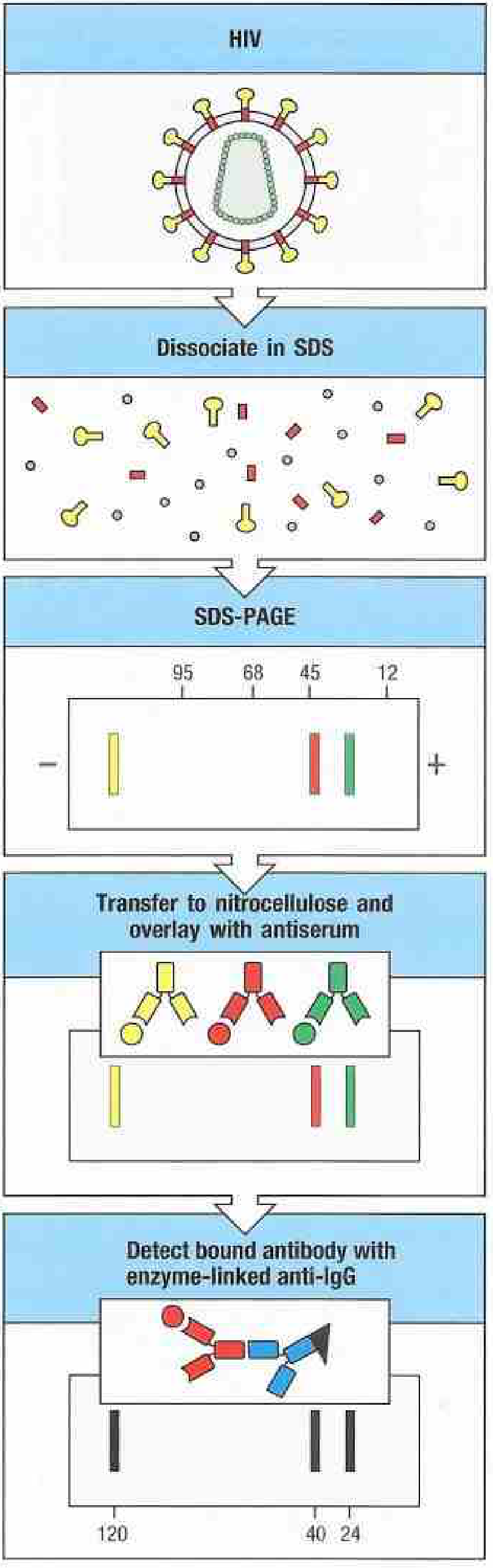 Western Blot - HIV example showing SDS dissociation, SDS-PAGE separation, nitrocellulose transfer, and antibody detection