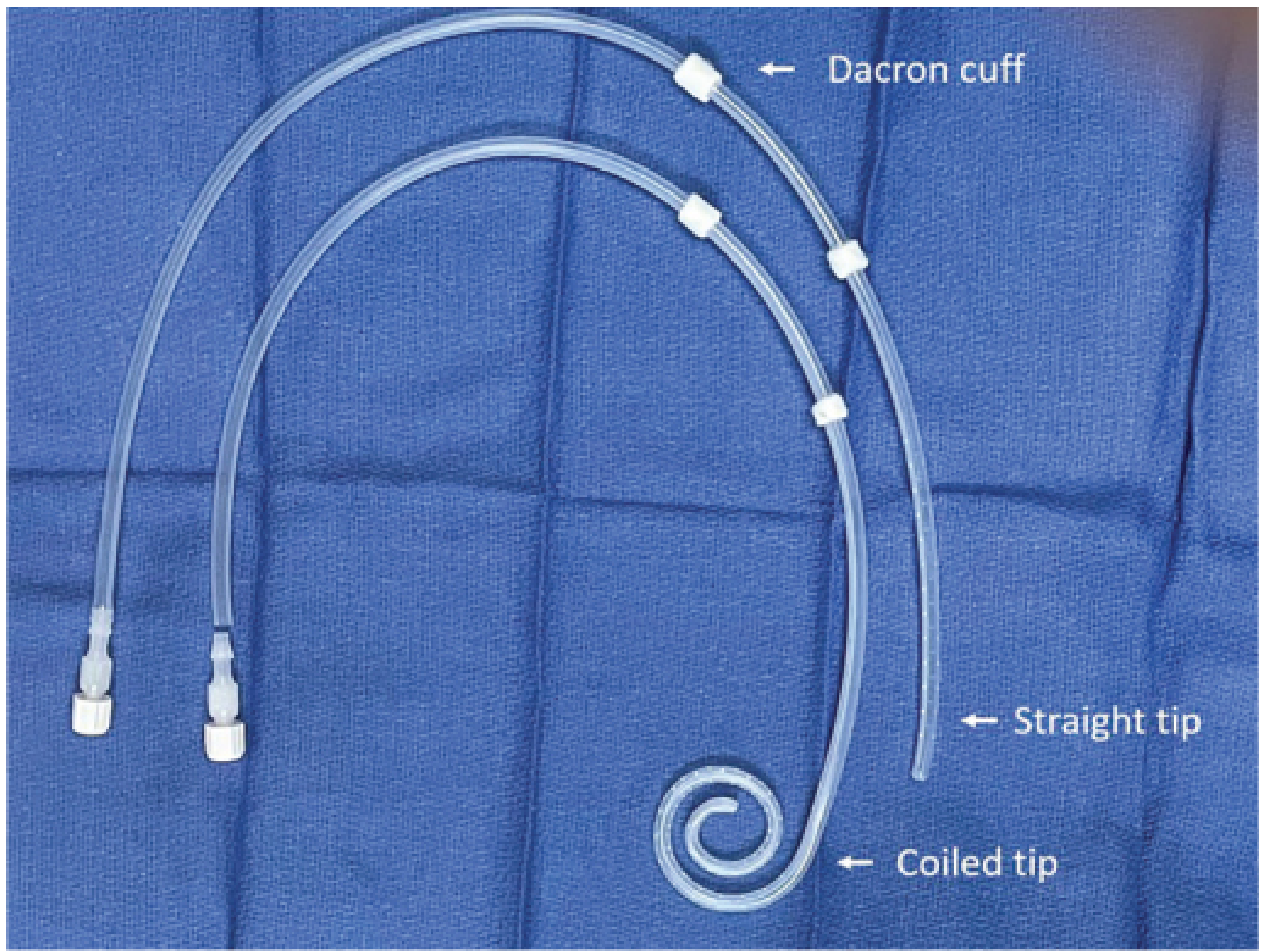 Silicone double-cuffed PD catheters showing straight tip and coiled tip variants with Dacron cuffs labeled
