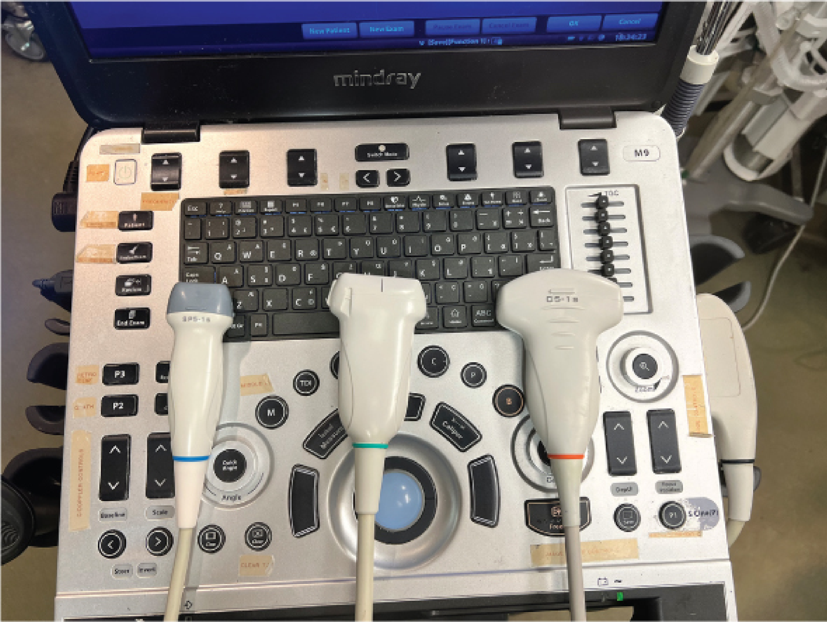 Ultrasound machine with three probes - linear, curvilinear, and phased array