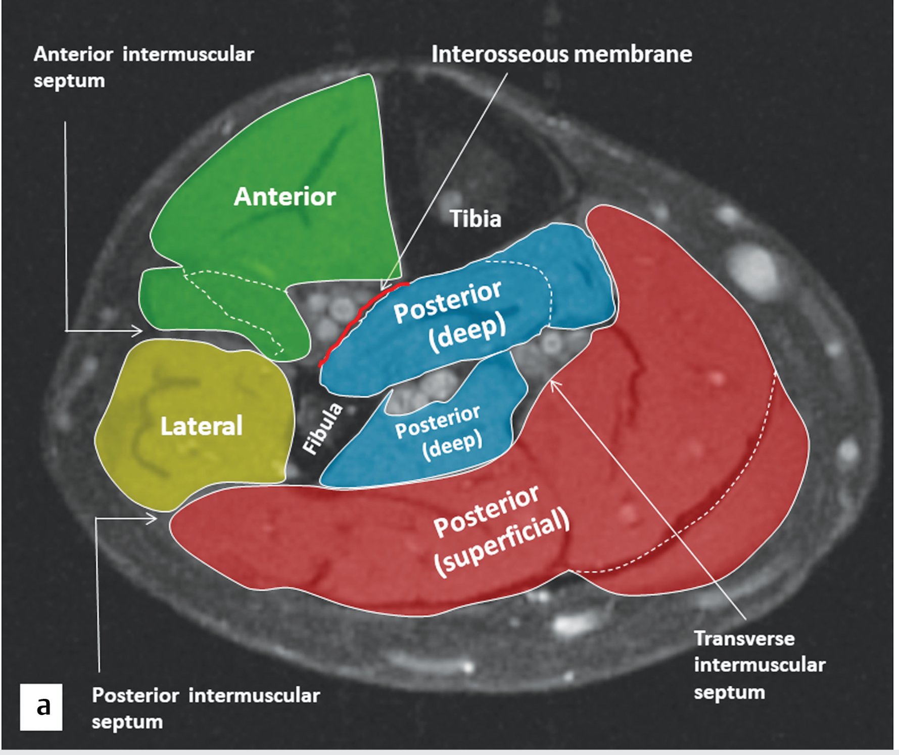 Four compartments of the leg