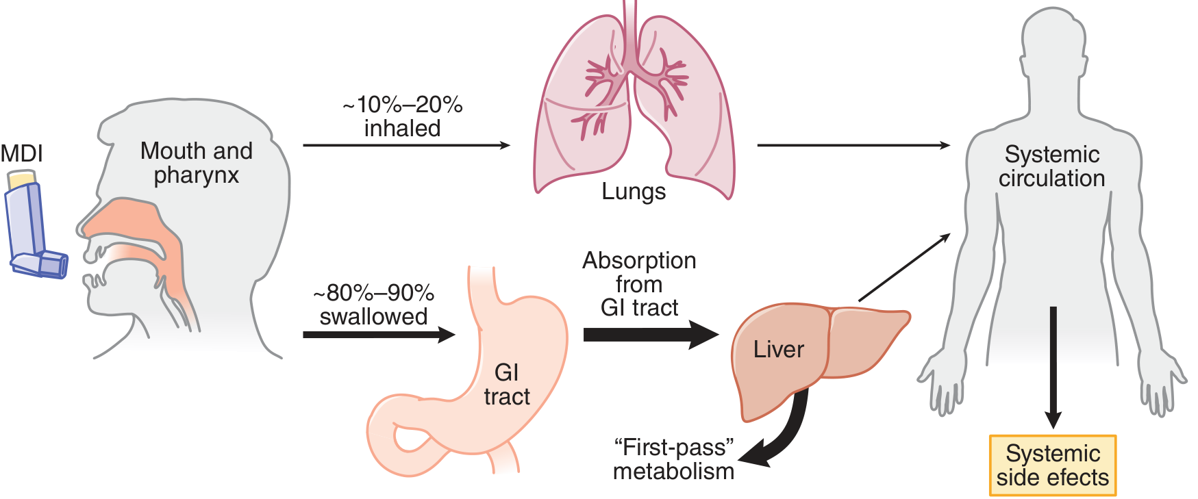 Schematic of inhaled drug deposition - showing ~10-20% reaching lungs and ~80-90% being swallowed