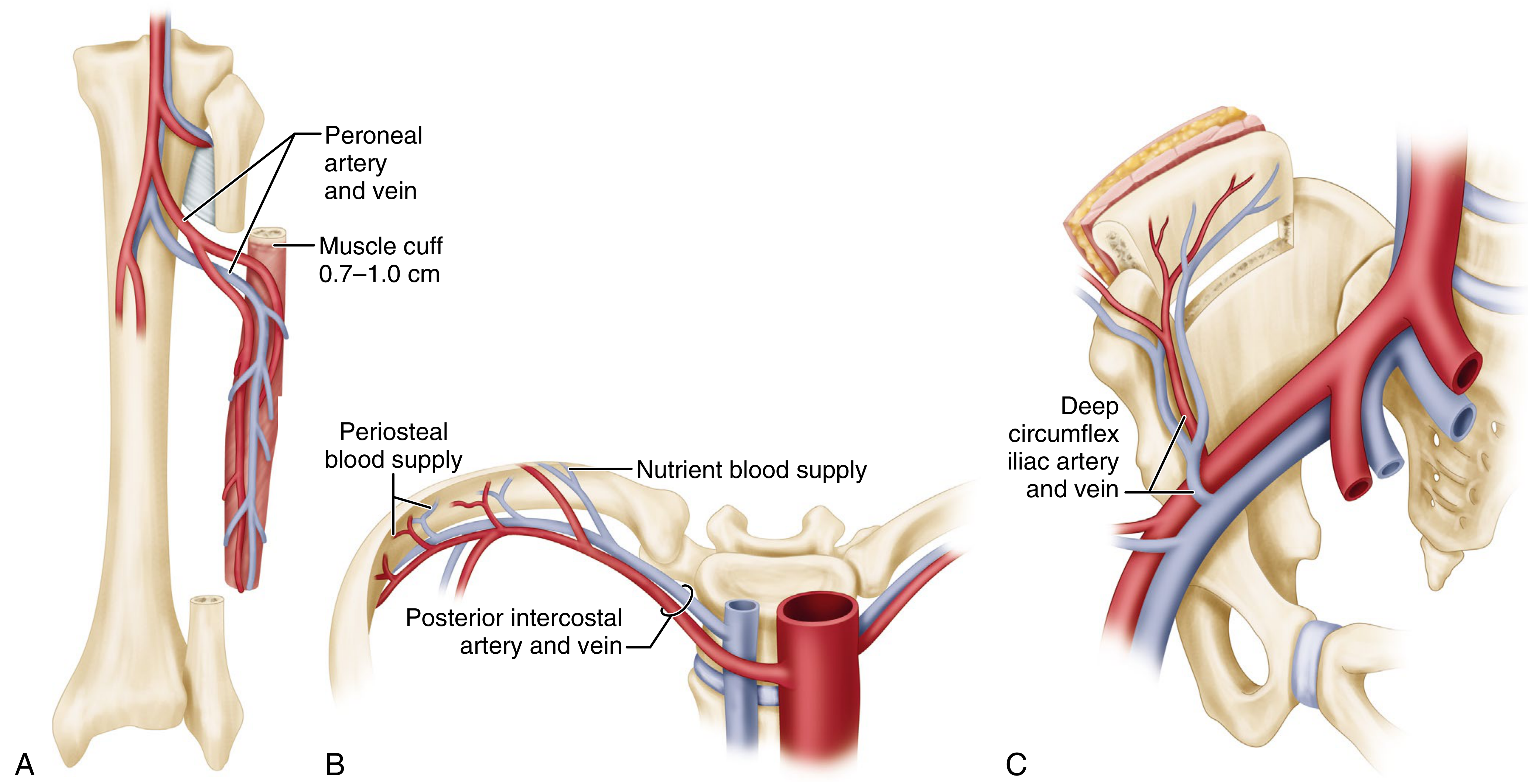 Vascularised bone graft donor sites: A) Fibula with peroneal vessels, B) Rib with posterior intercostal vessels, C) Iliac crest with deep circumflex iliac vessels