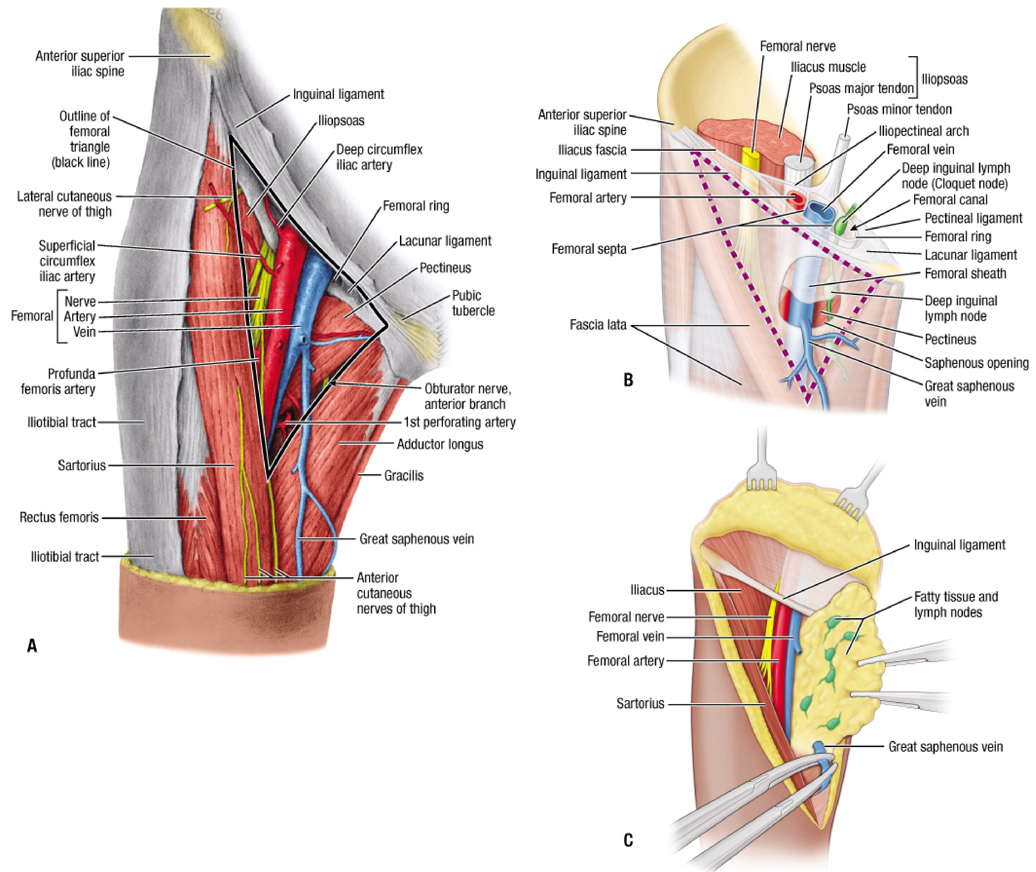 Femoral triangle showing superficial and deep inguinal lymph nodes, Node of Cloquet, saphenous opening, and femoral vein/artery/nerve relationships