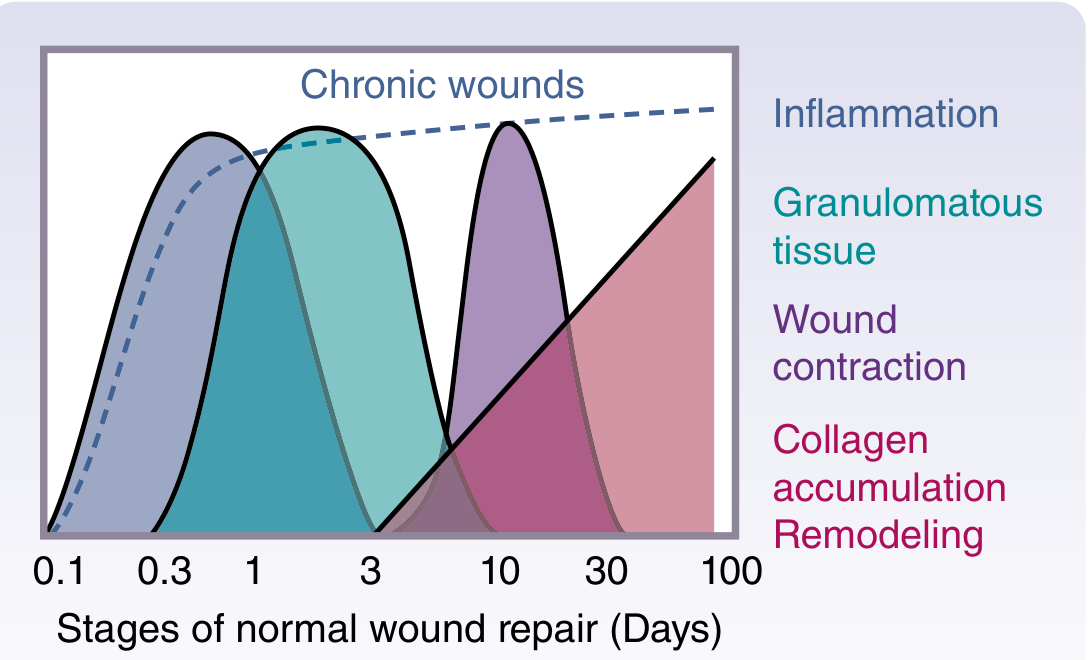 Stages of Normal Wound Repair - Timeline diagram showing overlapping phases