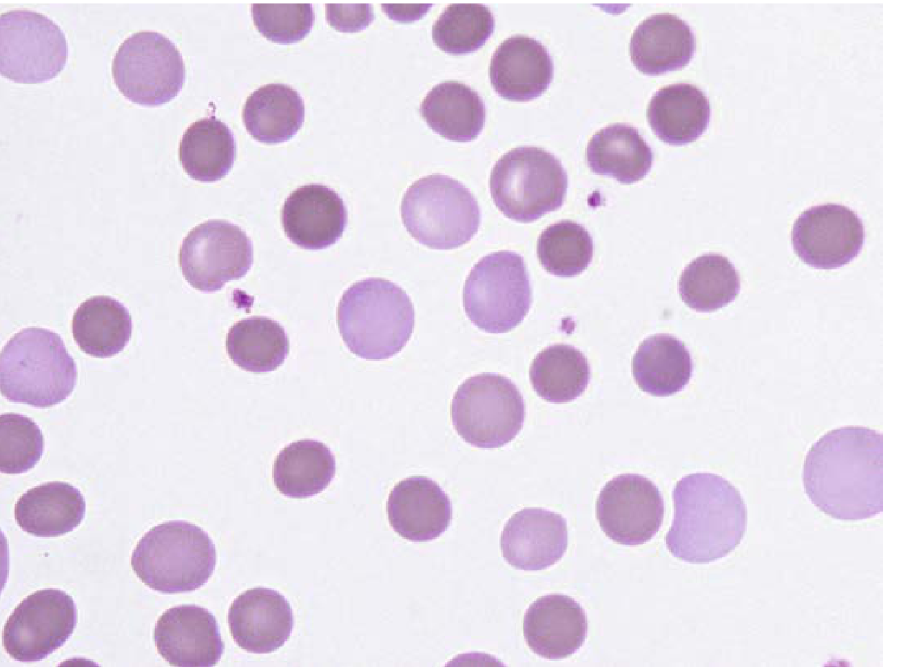 Polychromatic red cells - larger, blue-gray staining young cells lacking central pallor