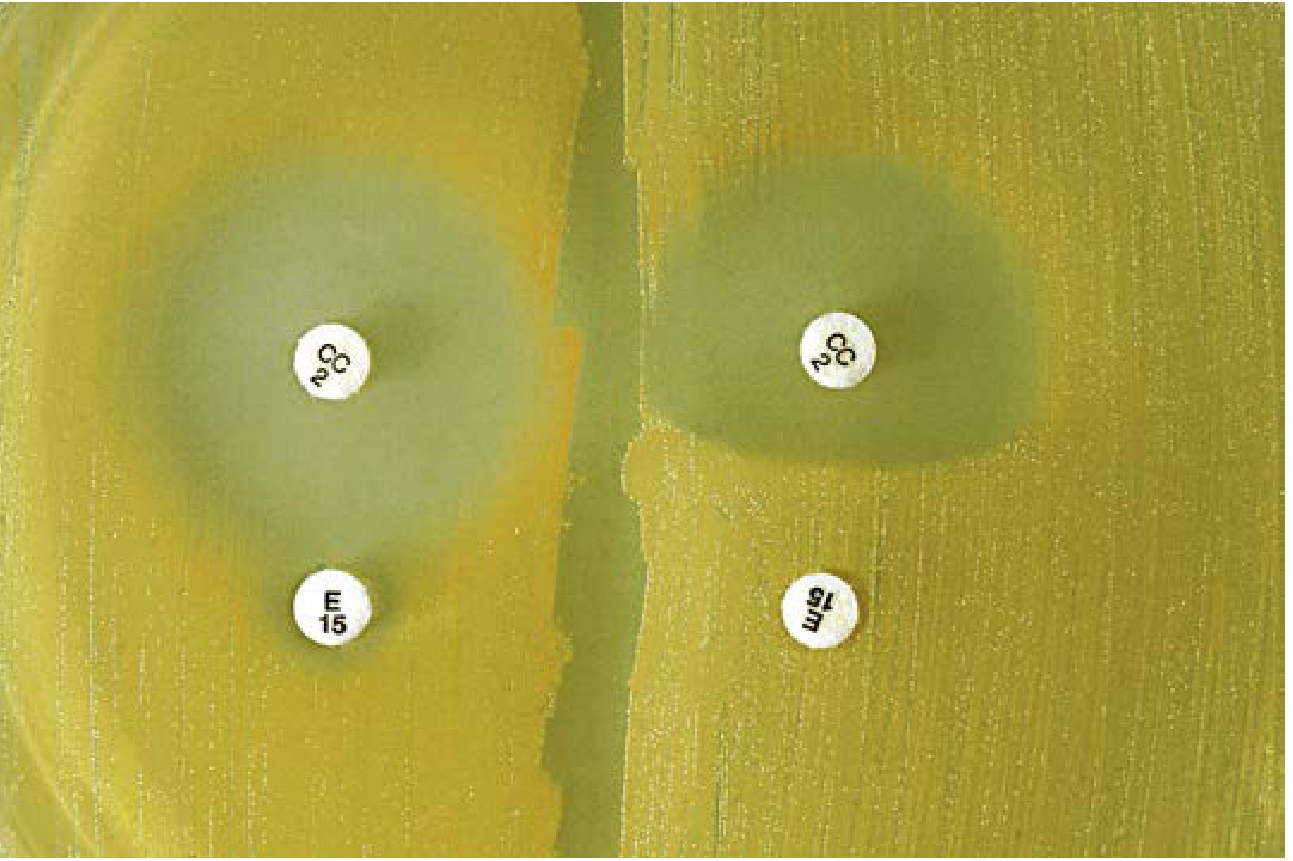 D-test on agar plate - actual photograph showing negative (left) and positive (right) results
