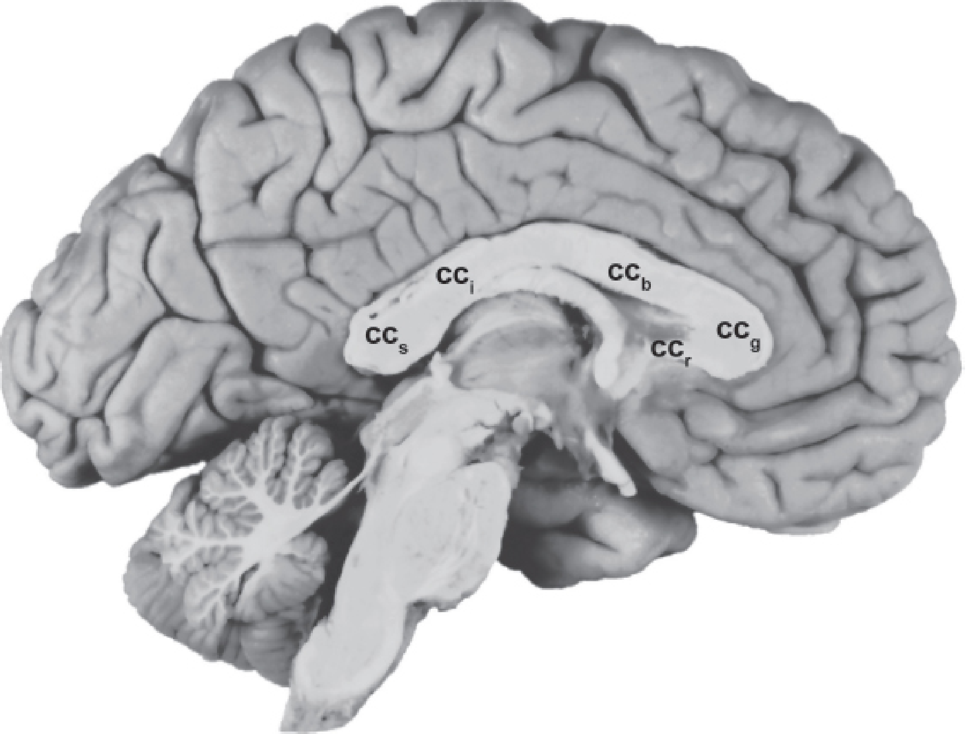Medial view of the right cerebral hemisphere showing all parts of the corpus callosum - CC_g (genu), CC_r (rostrum), CC_b (body), CC_i (isthmus), CC_s (splenium)