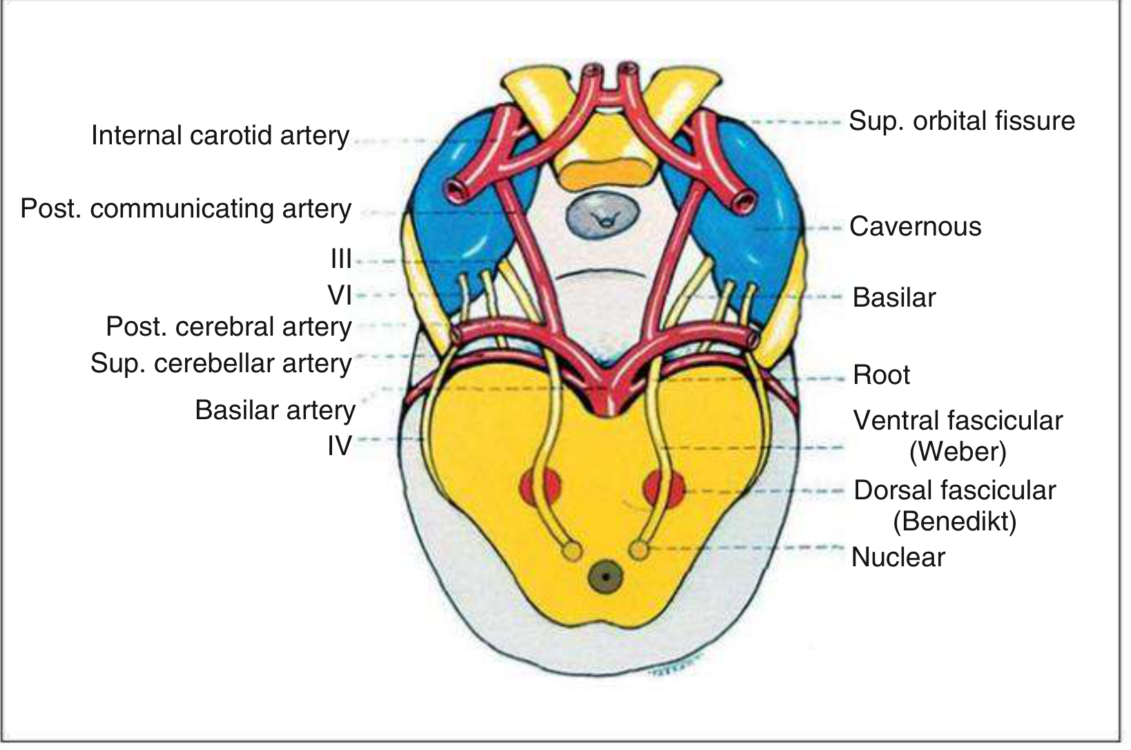 Dorsal view of the course of the third (oculomotor) nerve
