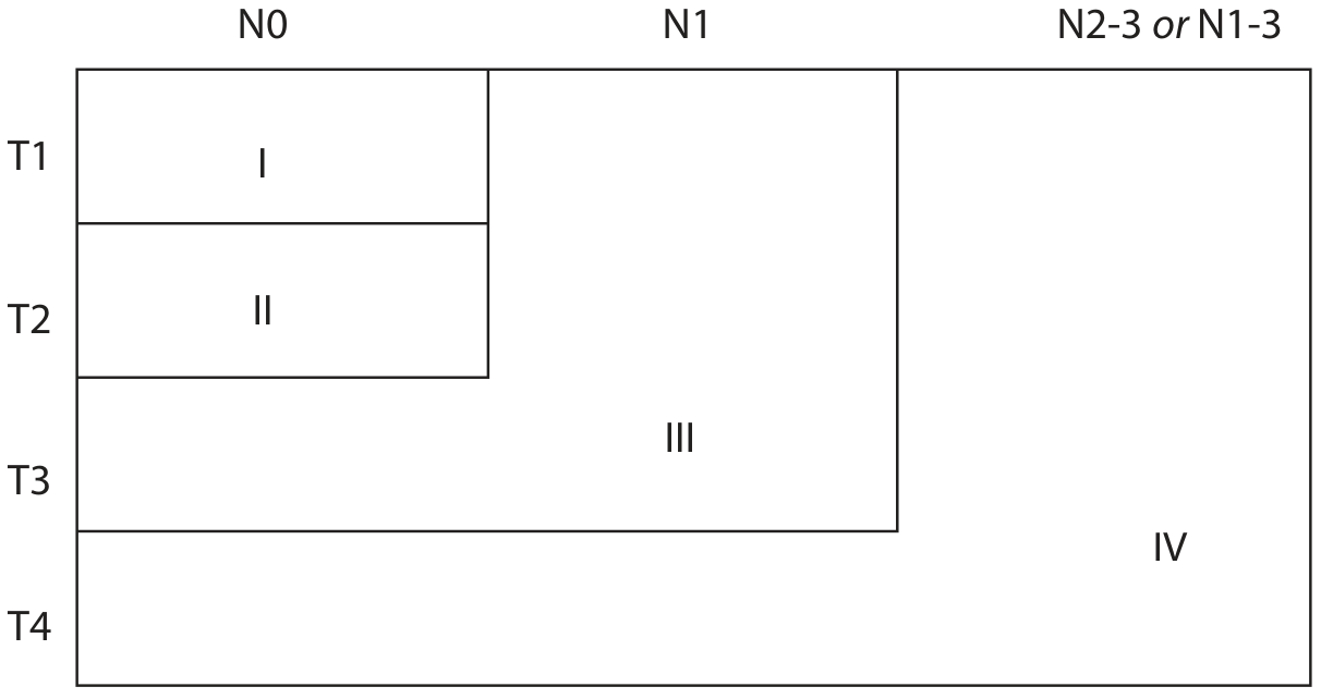 TNM staging diagram for oral cavity - Roman numerals I-IV based on T and N categories