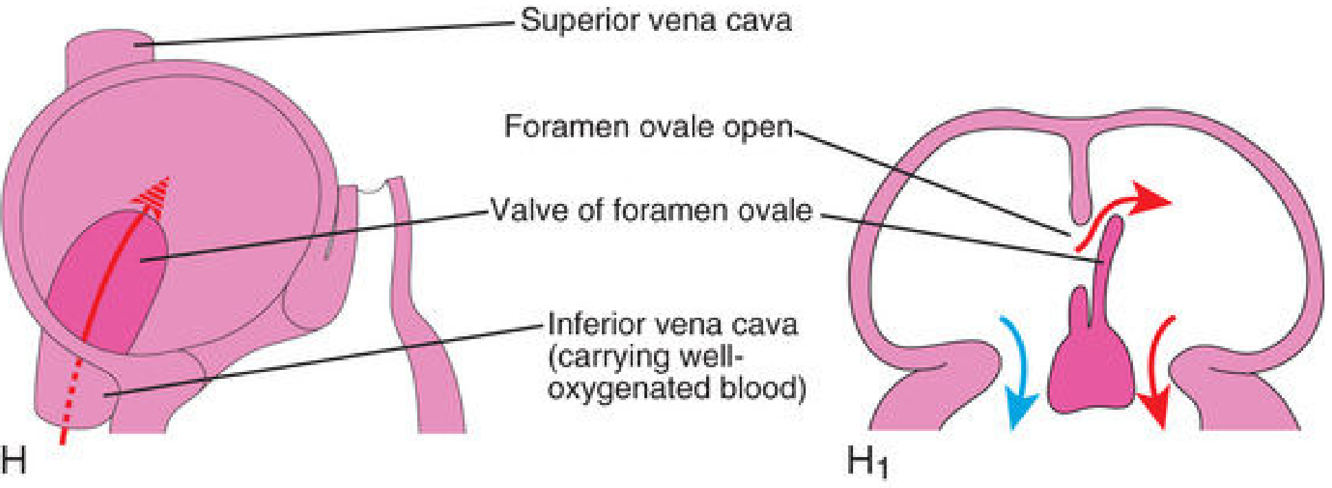 Final stage of interatrial septum development showing foramen ovale, valve of foramen ovale, and IVC directing oxygenated blood from right to left atrium