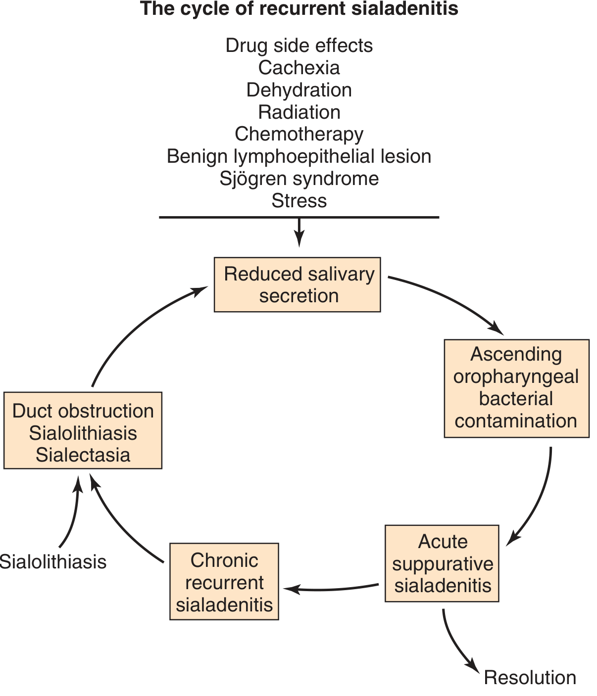 Cycle of recurrent sialadenitis - pathophysiology diagram