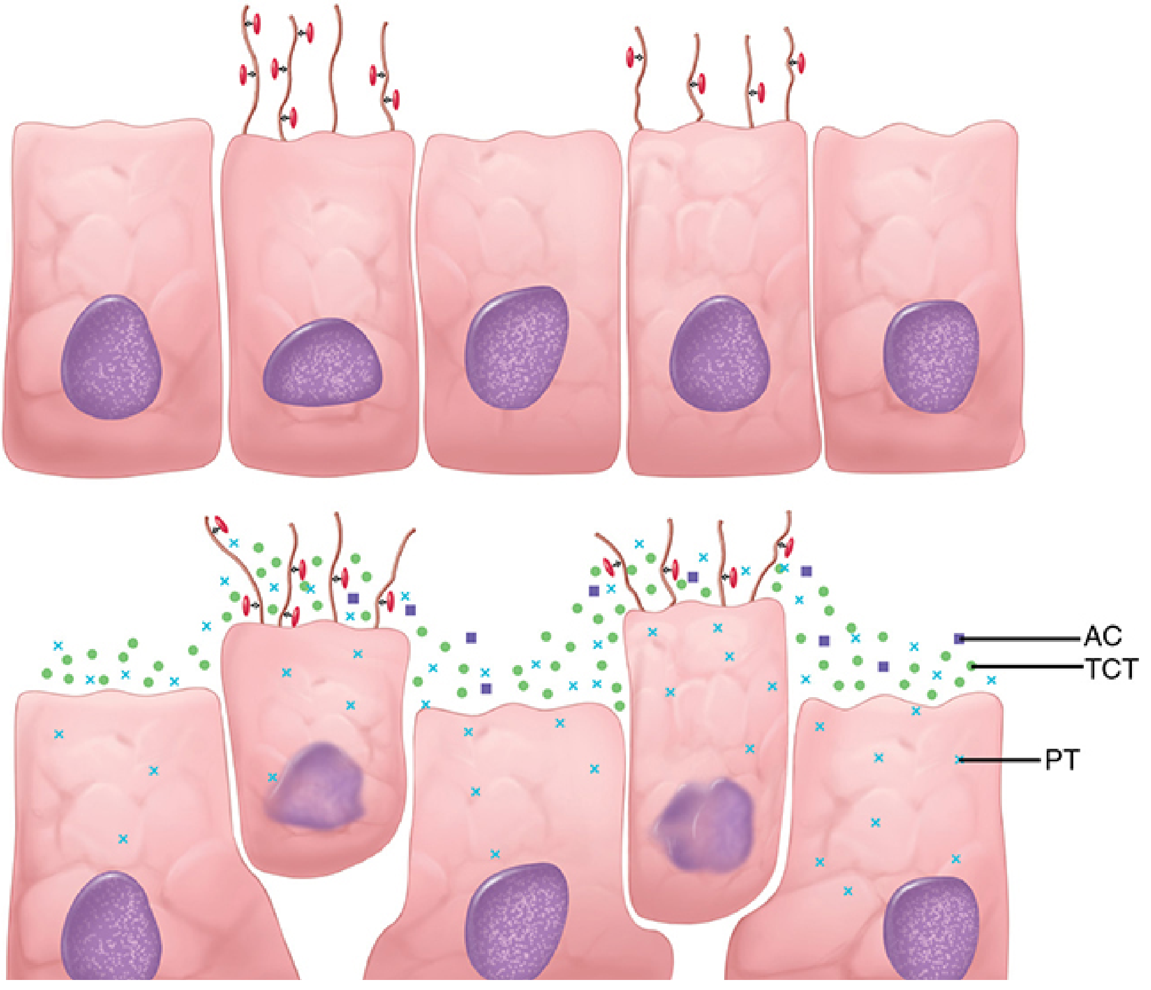 Whooping cough cellular view - B. pertussis attaching to ciliated respiratory epithelium, with secretion of PT, AC, and TCT causing progressive cell destruction