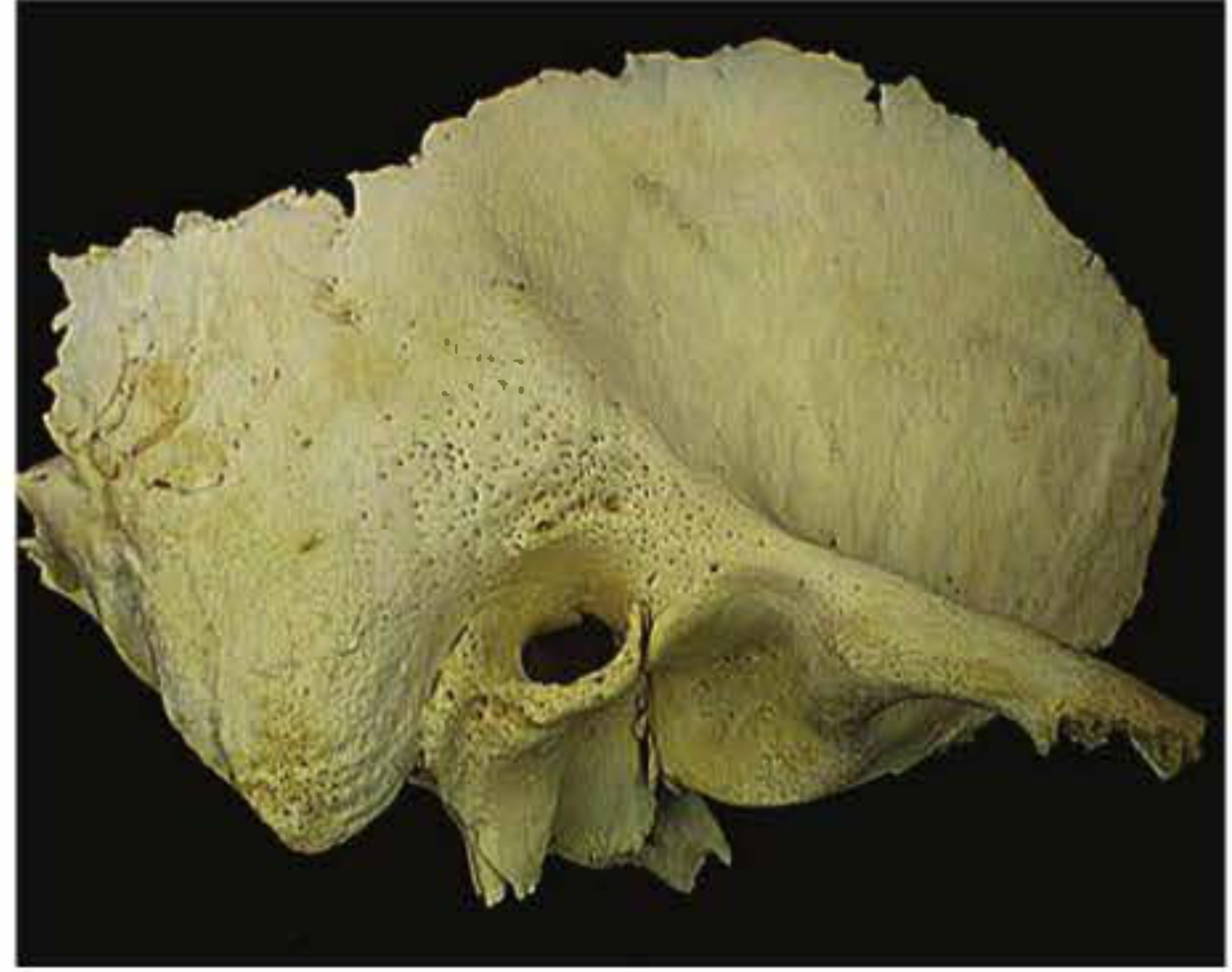 Lateral surface of temporal bone showing the mastoid region with cribriform pitting