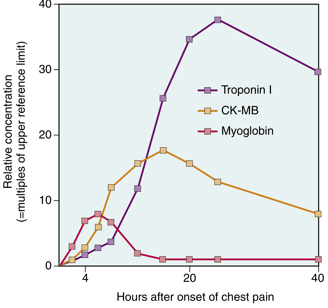 Cardiac biomarker kinetics after MI — Troponin I peaks at ~24 hours; CK-MB peaks at 24-48h; Myoglobin rises earliest but falls quickly