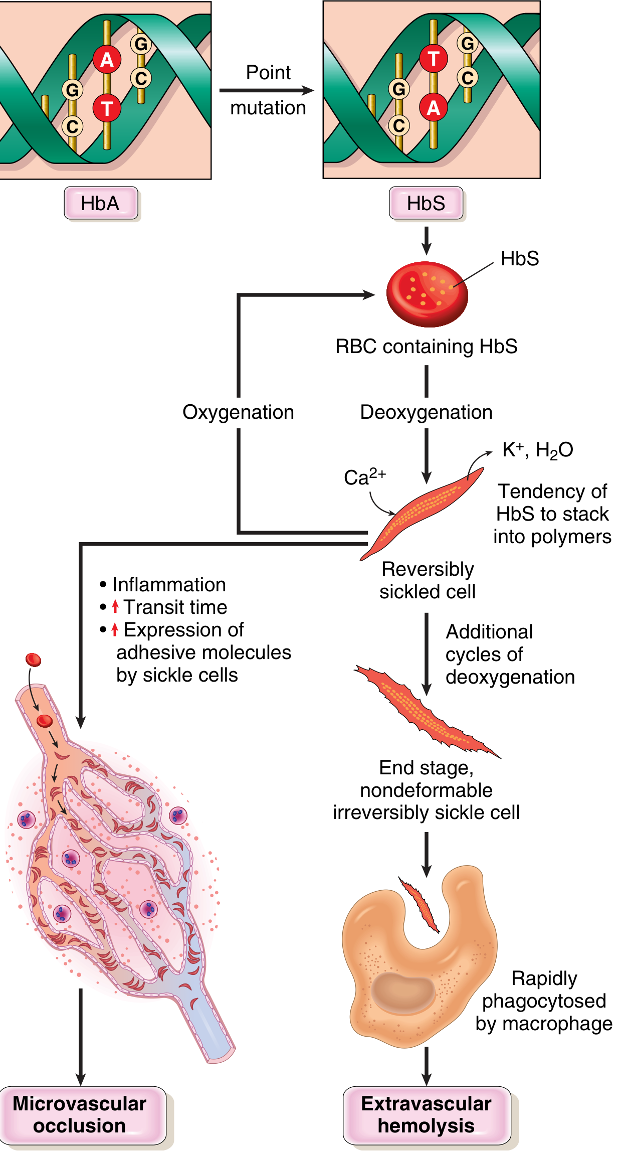 Sickle Cell Pathogenesis Diagram