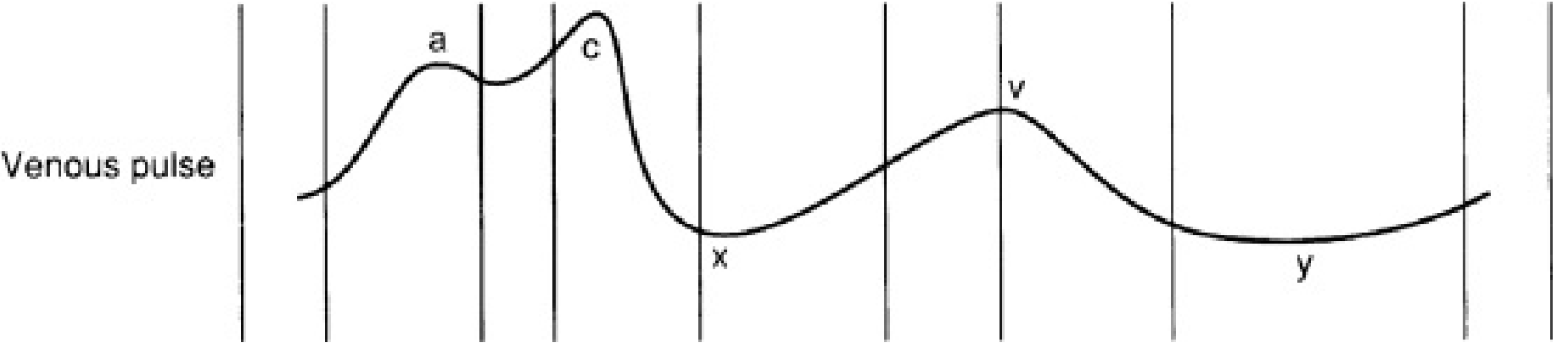 JVP basic waveform — a, c, x, v, y labeled
