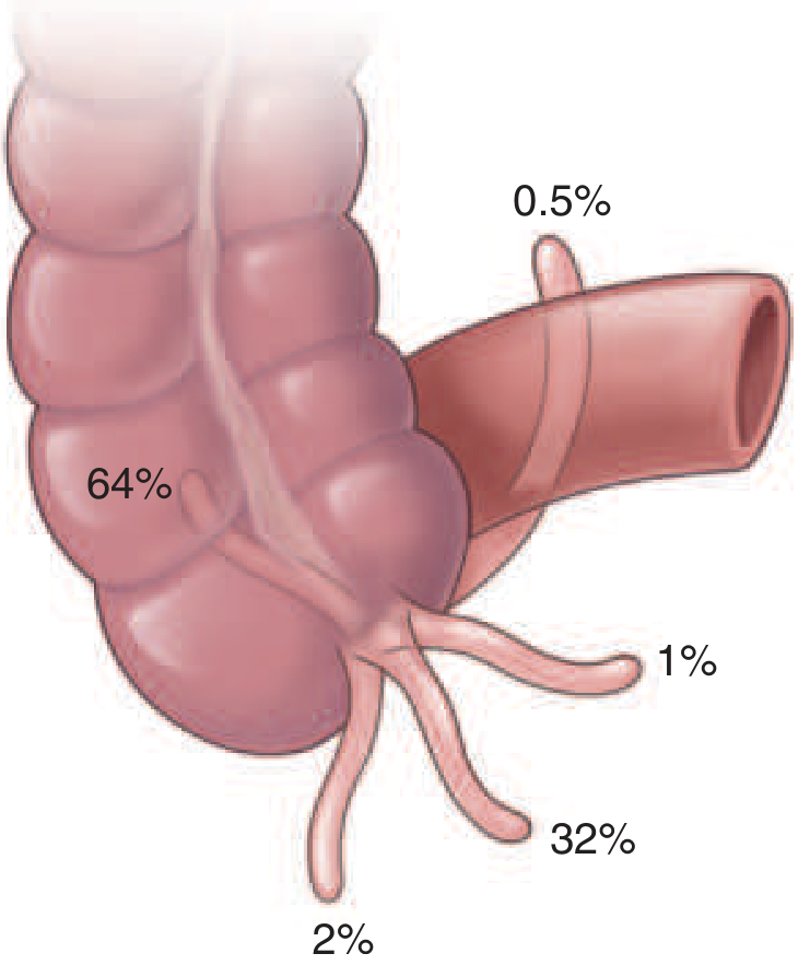 Regional anatomic variations of the appendix - Harrison's