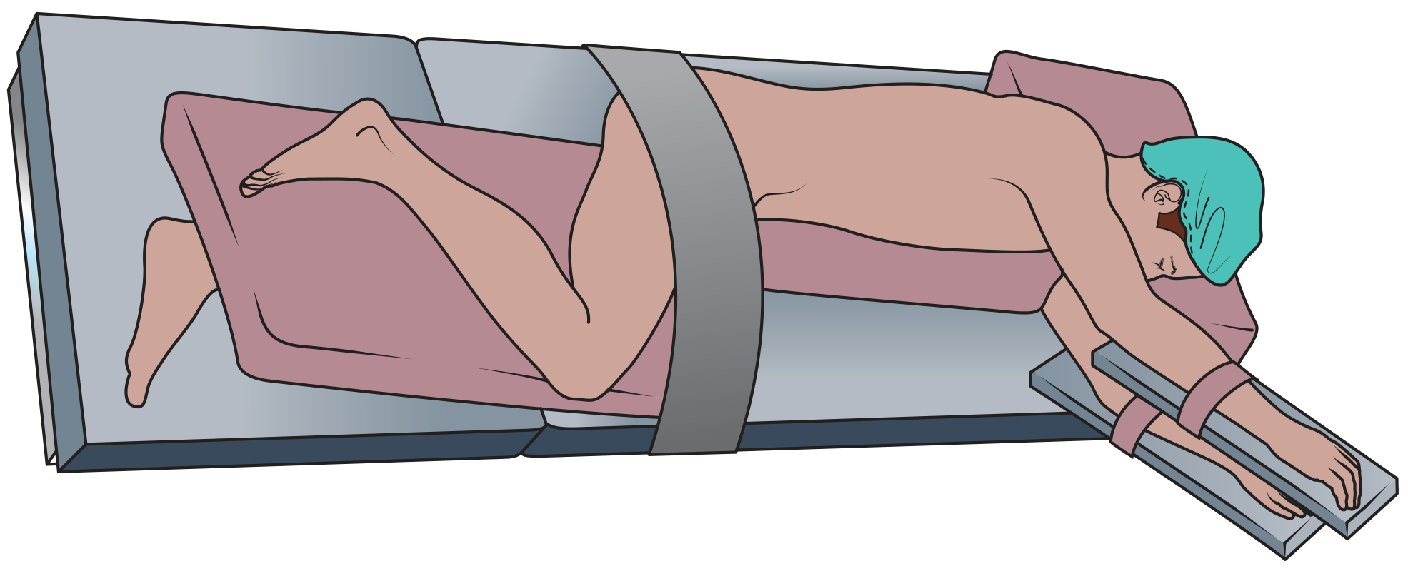 Left lateral position - patient on side with upper leg flexed, stabilised with stirrups and strap across pelvis, arm on arm board