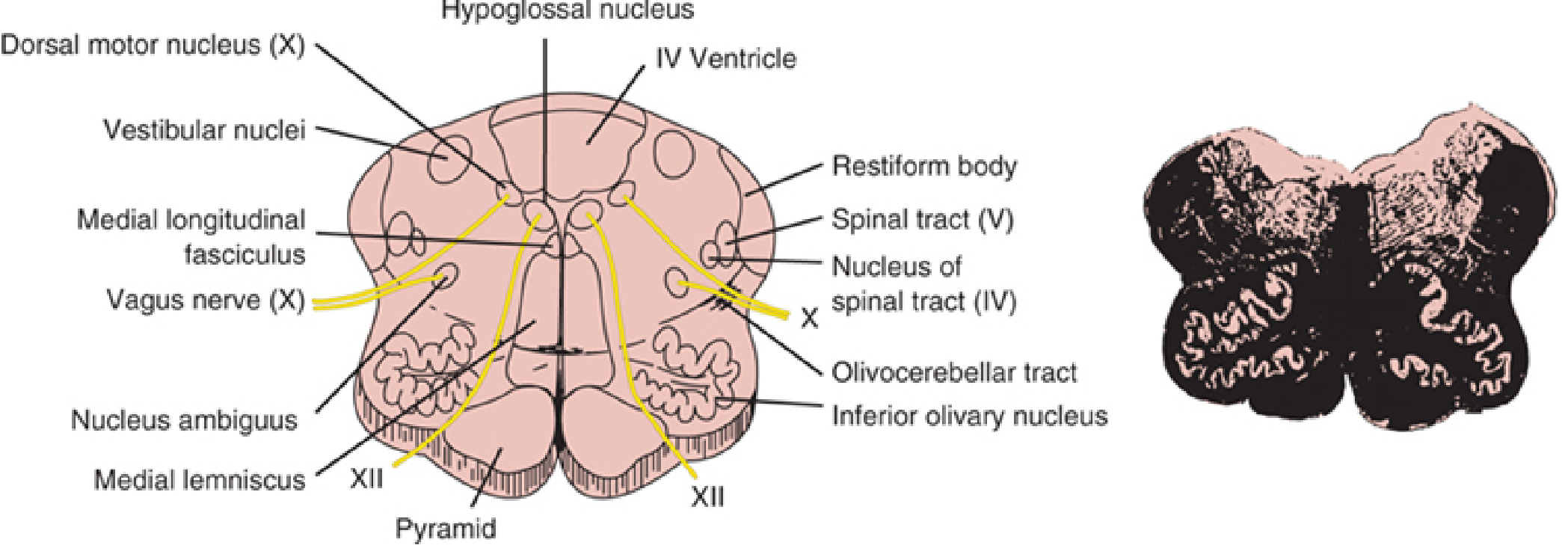 Textbook cross-section of mid-medulla at olive level showing inferior olivary nucleus, medial lemniscus, pyramid, hypoglossal nucleus, dorsal motor nucleus of vagus, nucleus ambiguus, vestibular nuclei, spinal tract and nucleus of CN V, restiform body and 4th ventricle