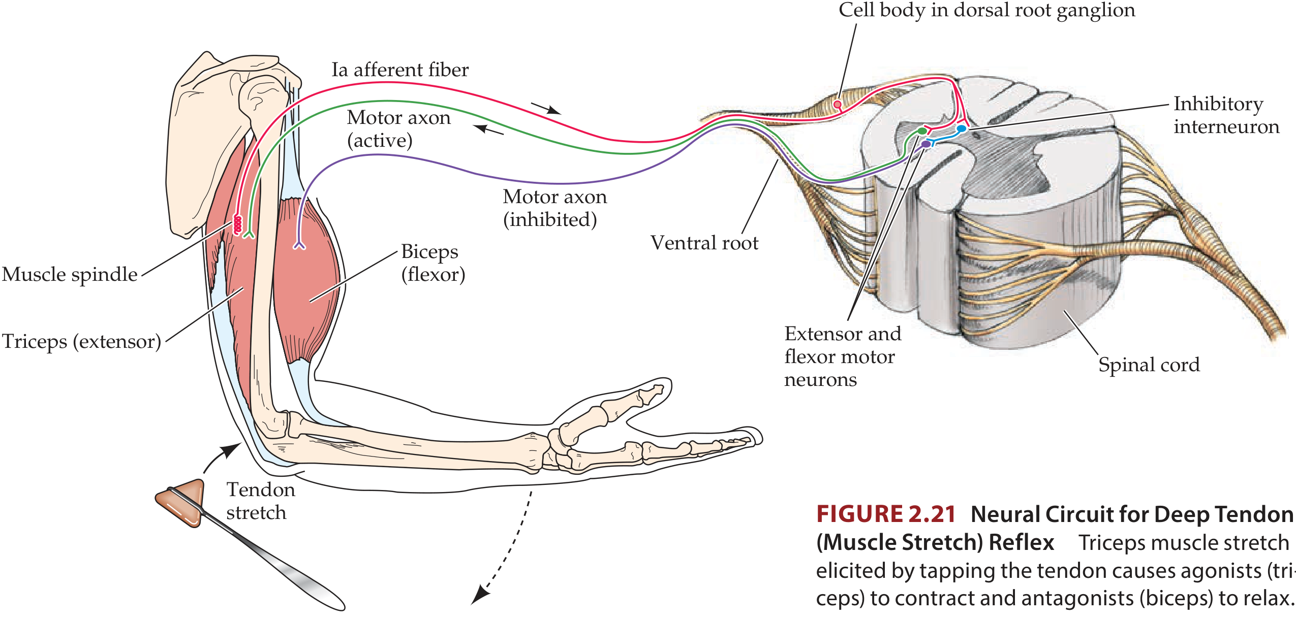 Neural circuit for the deep tendon (muscle stretch) reflex - Ia afferent fiber from muscle spindle travels to spinal cord, synapses on motor neuron, which activates agonist (triceps) and inhibits antagonist (biceps)