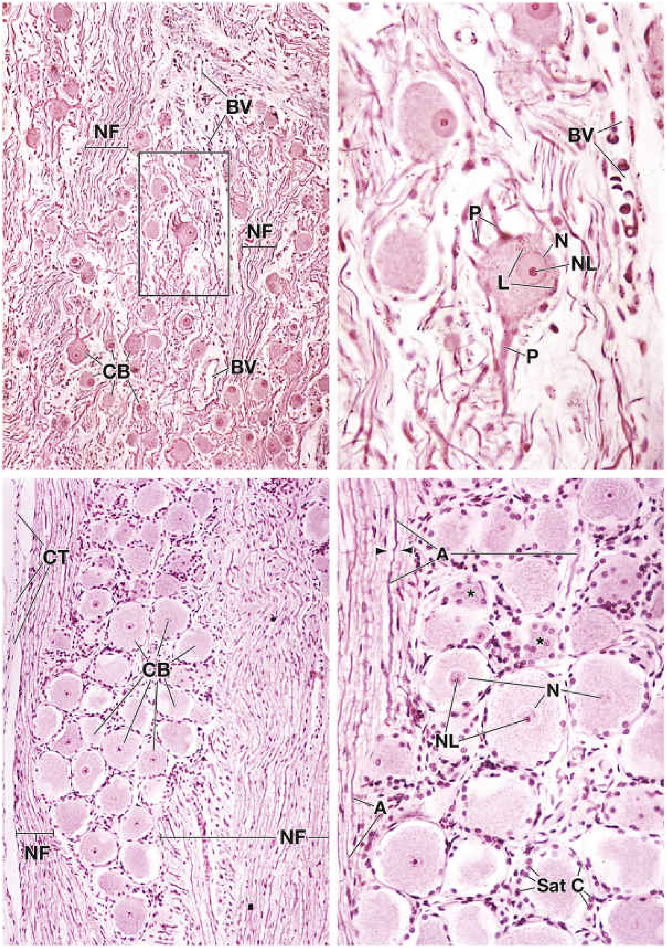 Sympathetic ganglion (top) vs. Dorsal root ganglion (bottom) - H&E histology