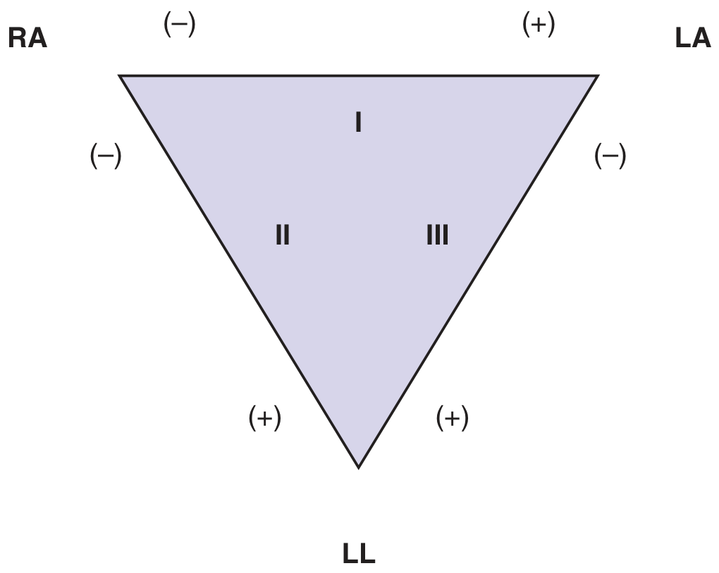 Einthoven's Triangle showing RA, LA, LL electrode placement with polarity for leads I, II, III