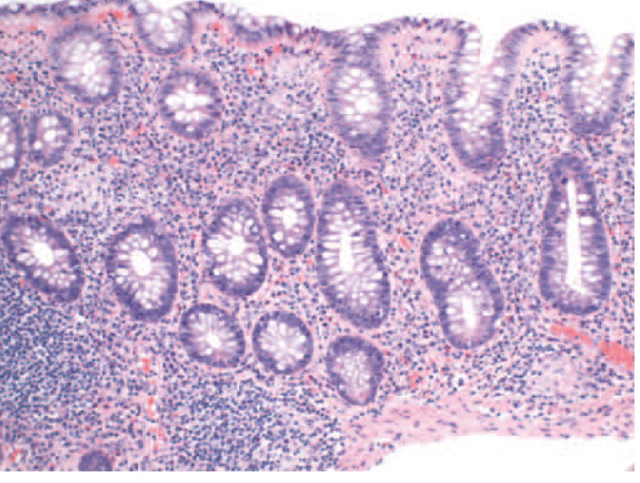 CD Histology