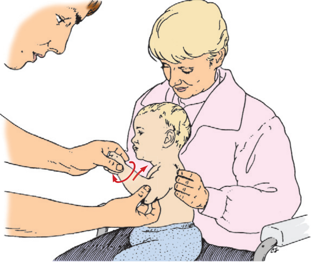 Supination and flexion reduction maneuver for nursemaid's elbow