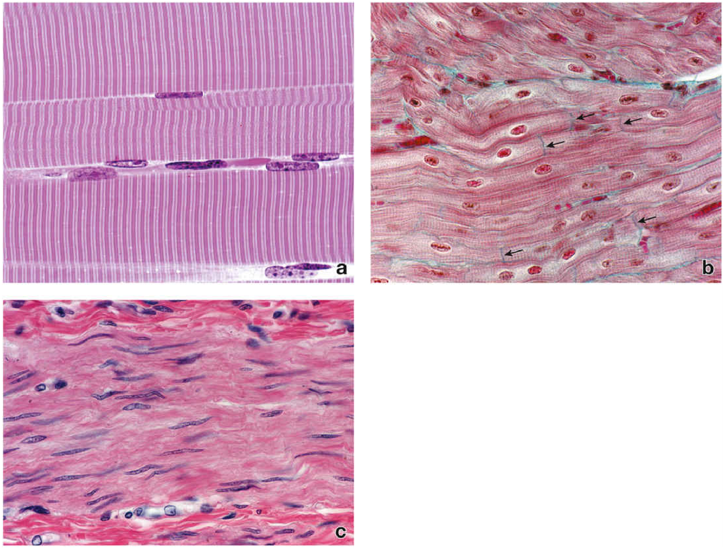 Three muscle types: (a) skeletal - long fibers with peripheral nuclei and cross-striations; (b) cardiac - branching fibers with intercalated discs; (c) smooth - spindle-shaped cells with central elongated nuclei, no striations