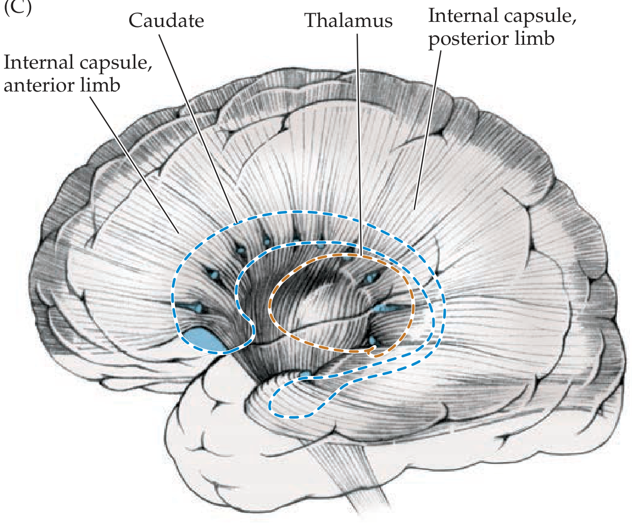 Lateral dissection view showing anterior and posterior limb of internal capsule in relation to caudate, thalamus and lentiform nucleus